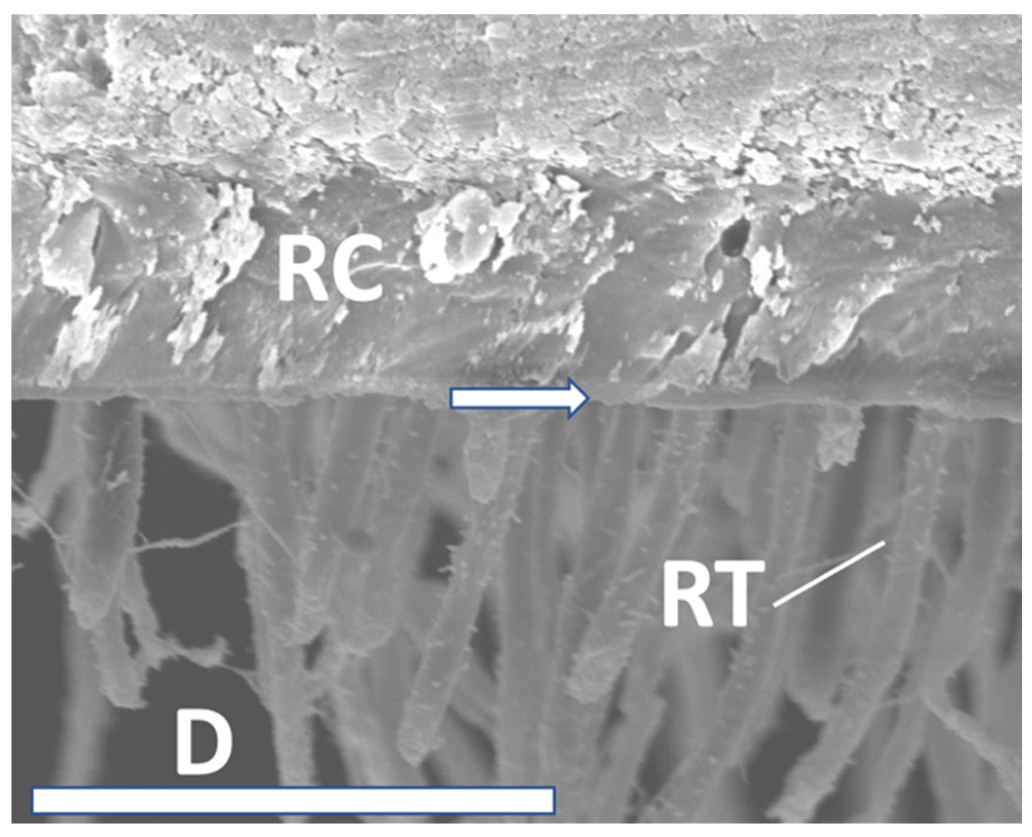 Materials 16 05948 g008