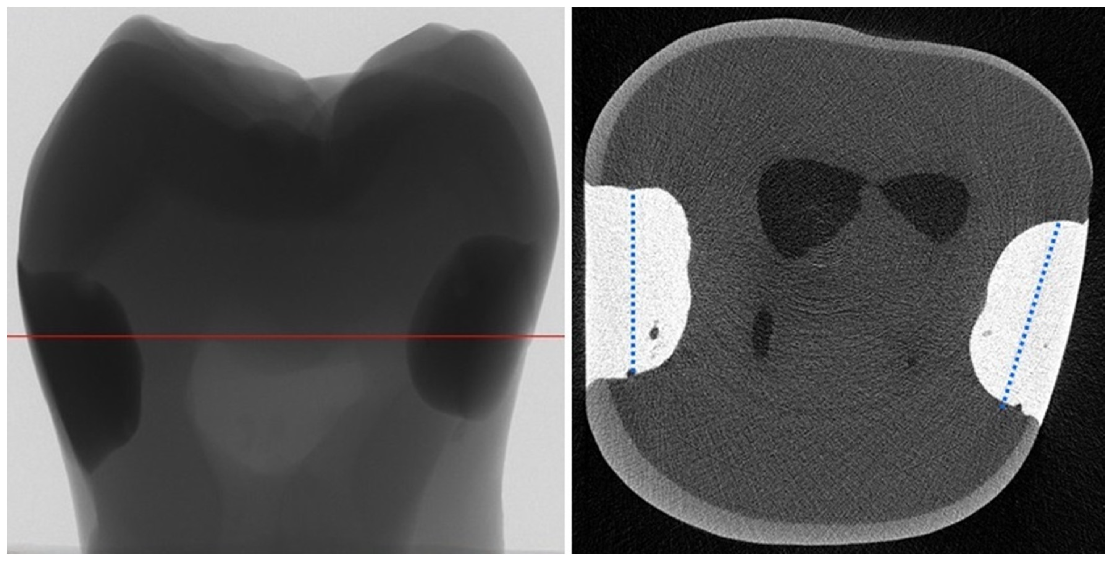 Materials 17 00636 g002