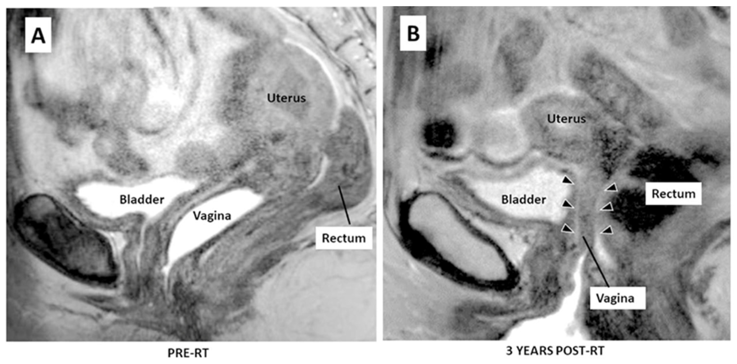 Materials 17 01050 g001