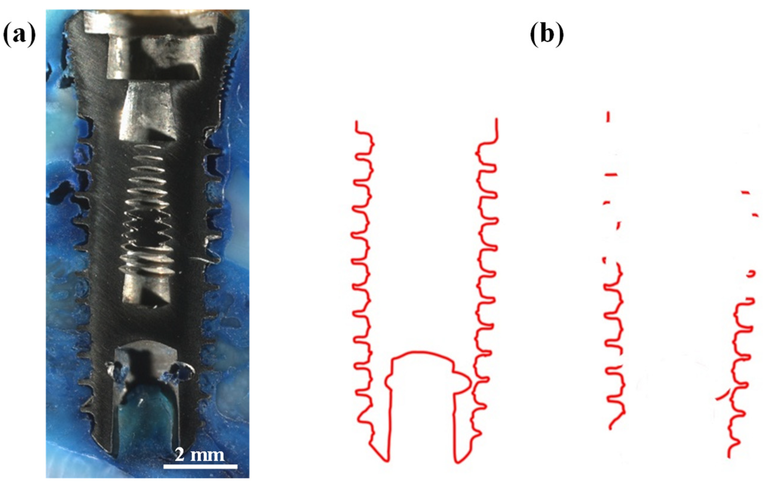 Materials 17 02276 g002