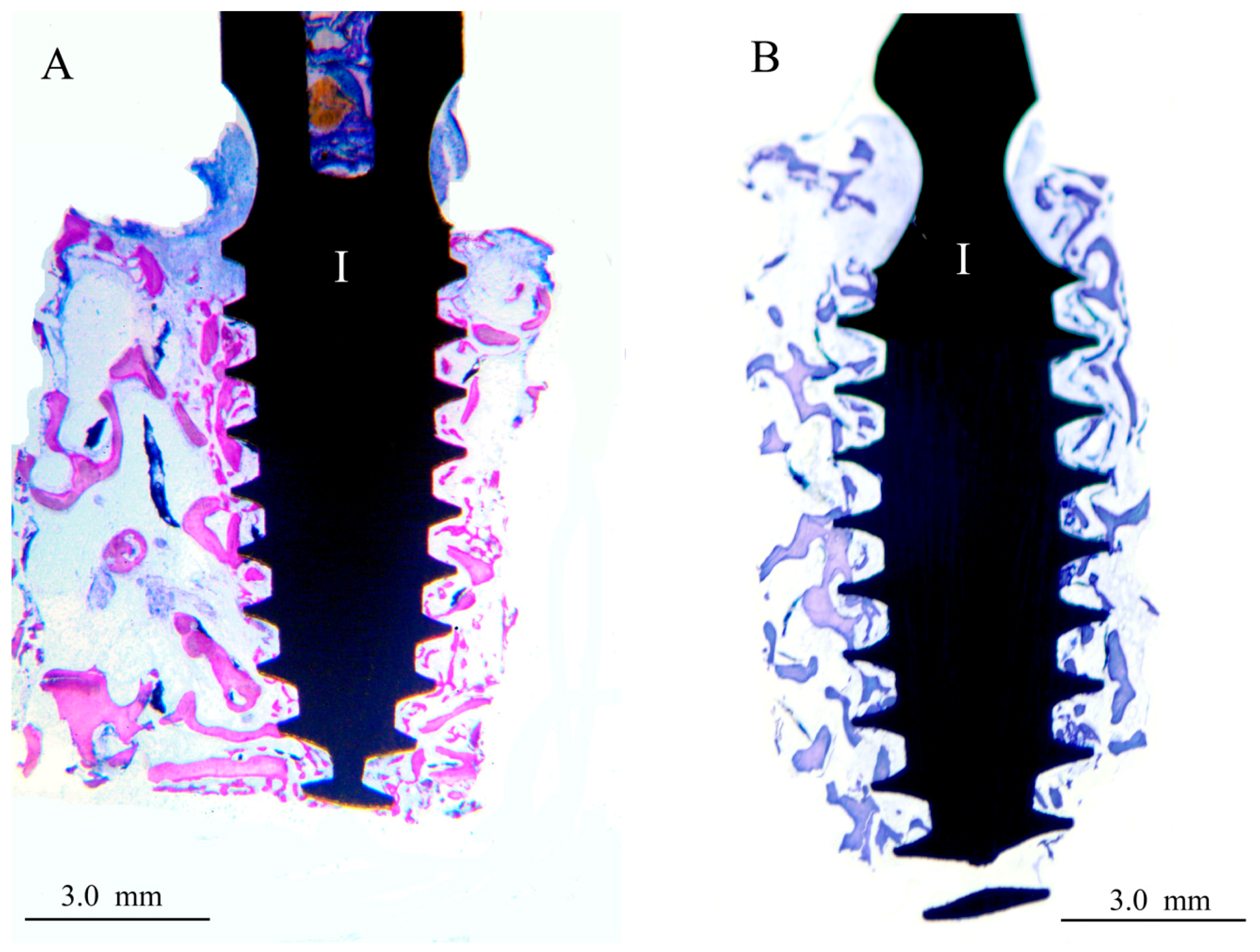 Materials 17 02331 g002