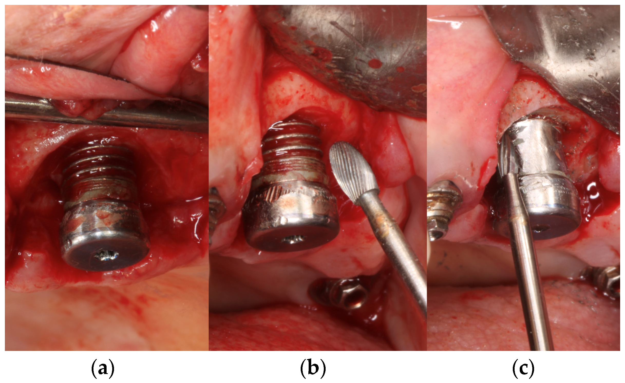 Materials 17 02944 g002a Materials 17 02944 g002a