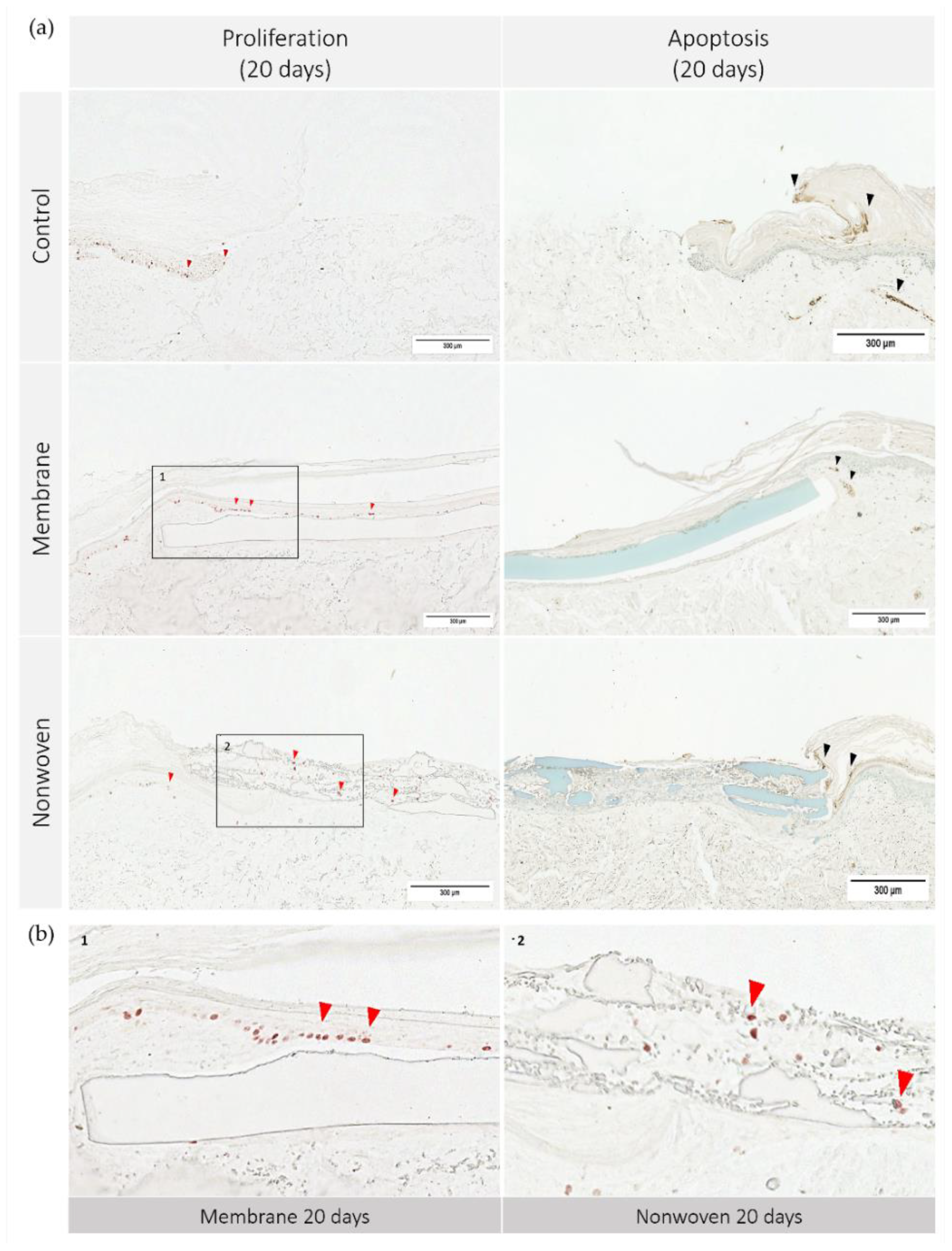 Materials 17 03004 g007