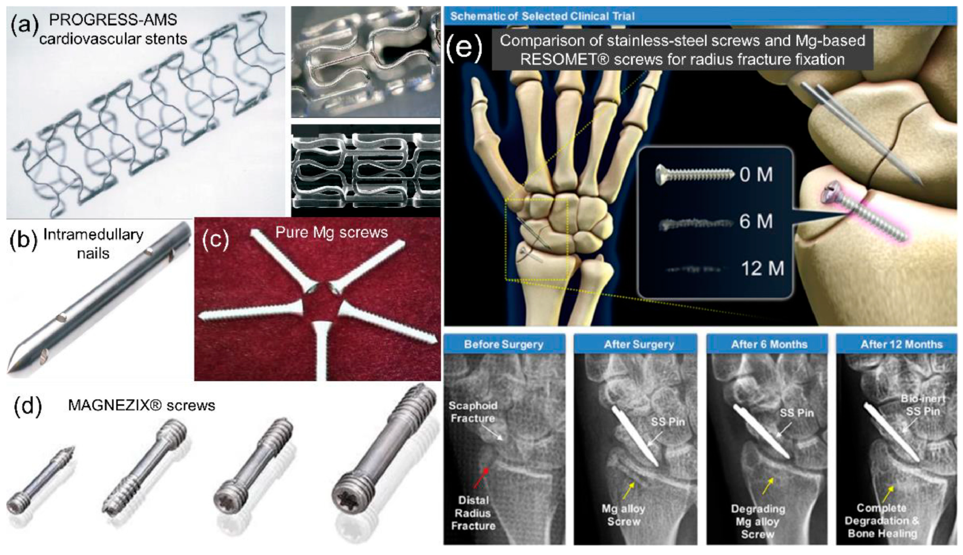 Materials 17 03851 g001