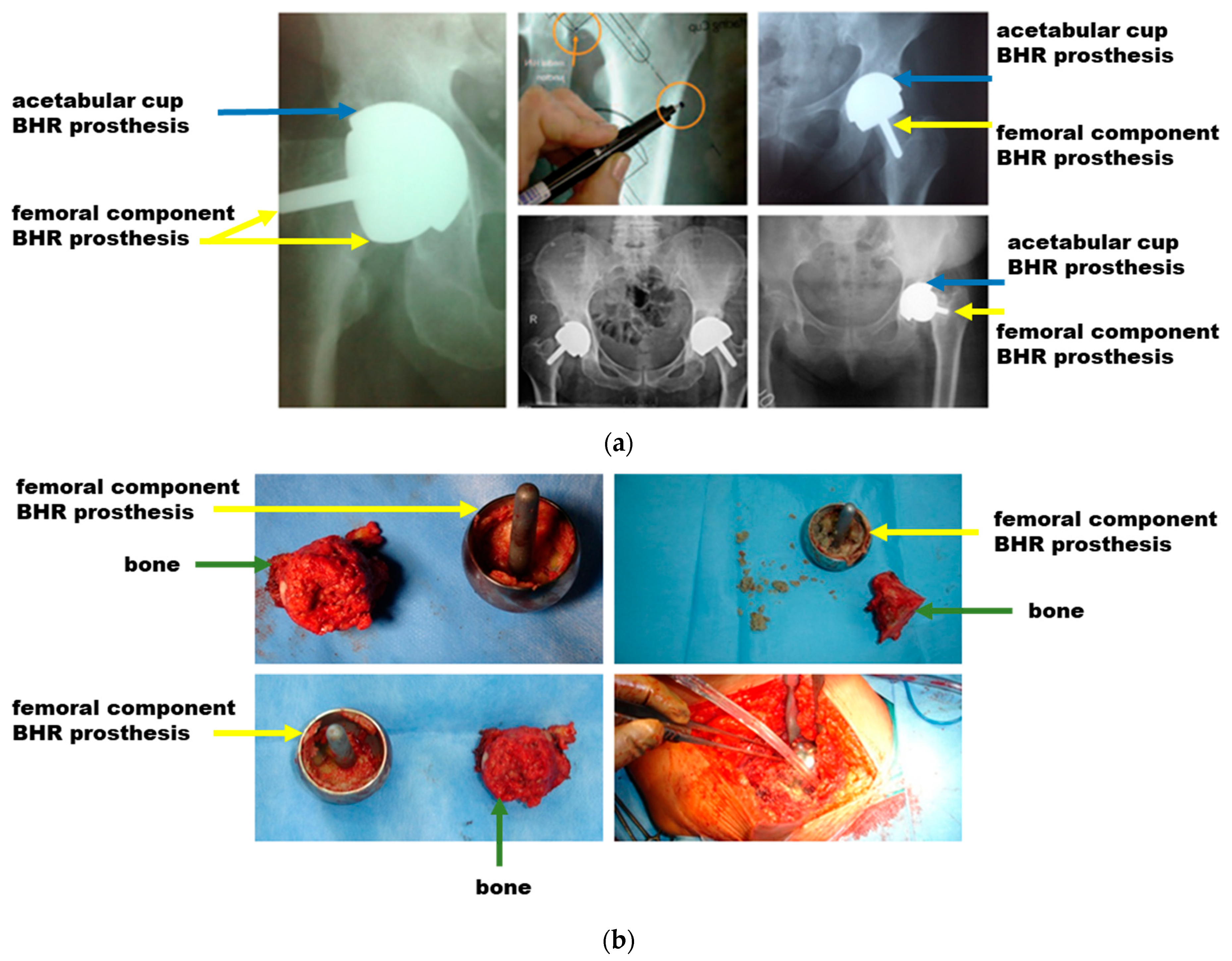 Materials 17 03965 g004