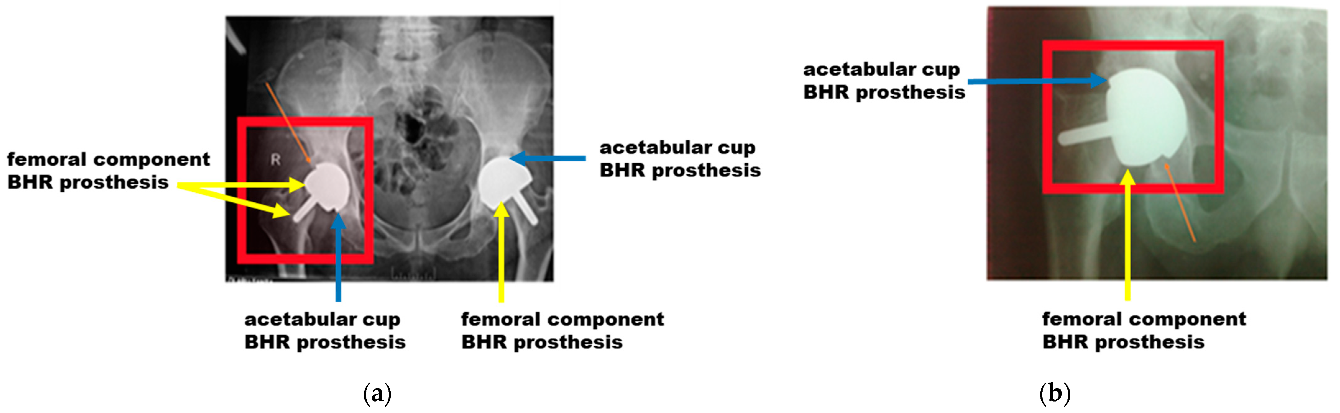 Materials 17 03965 g006