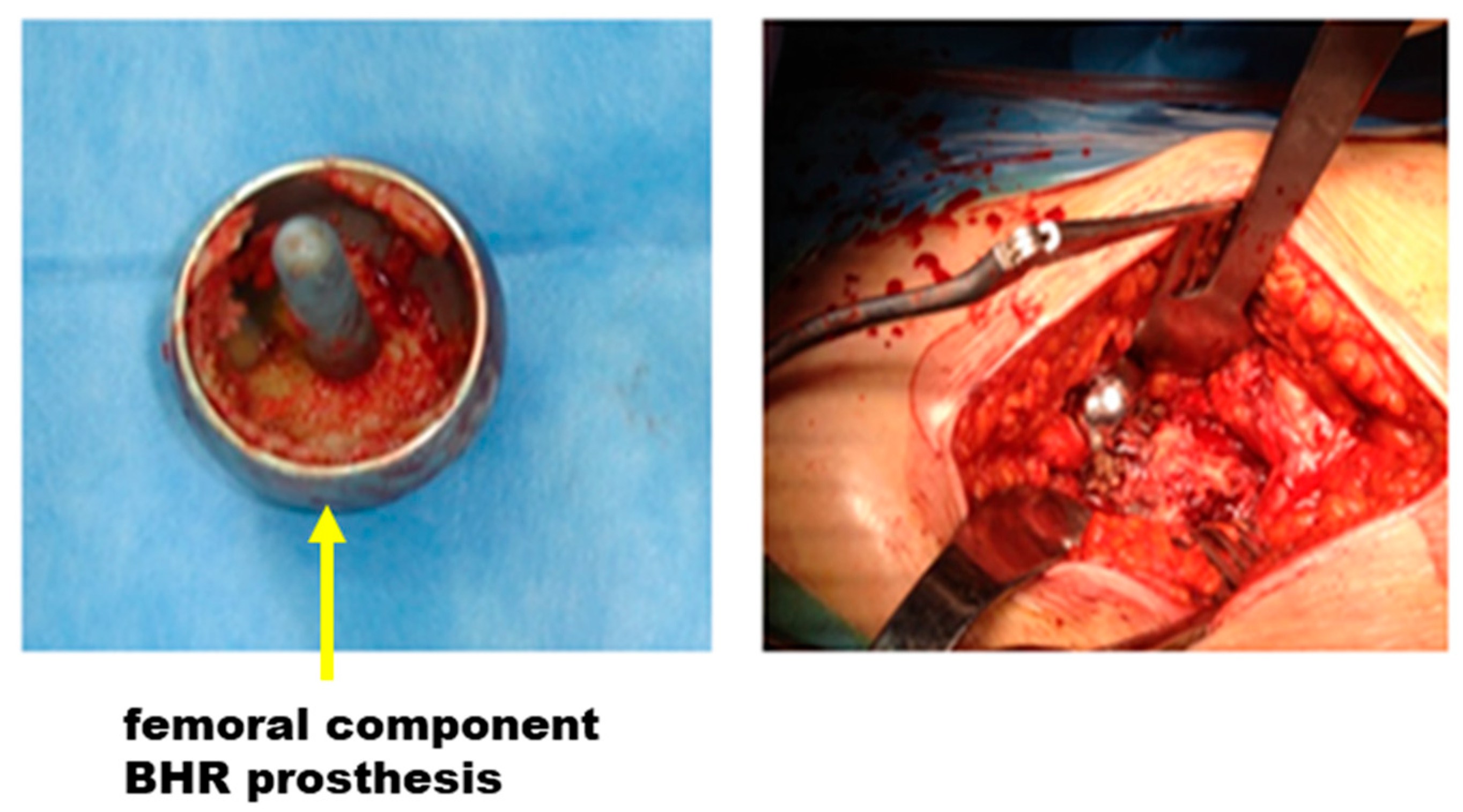 Materials 17 03965 g008