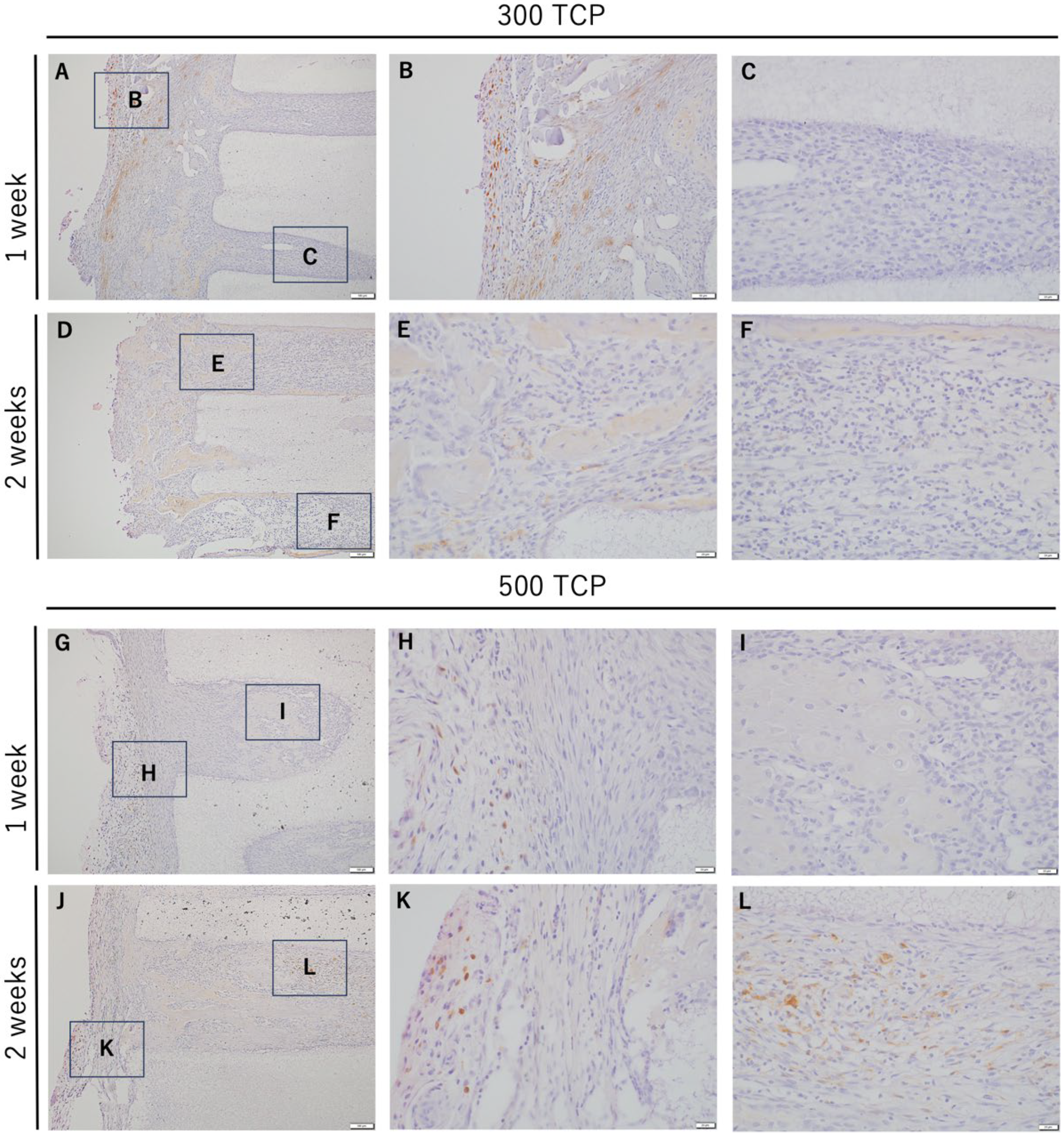 Materials 17 04108 g005