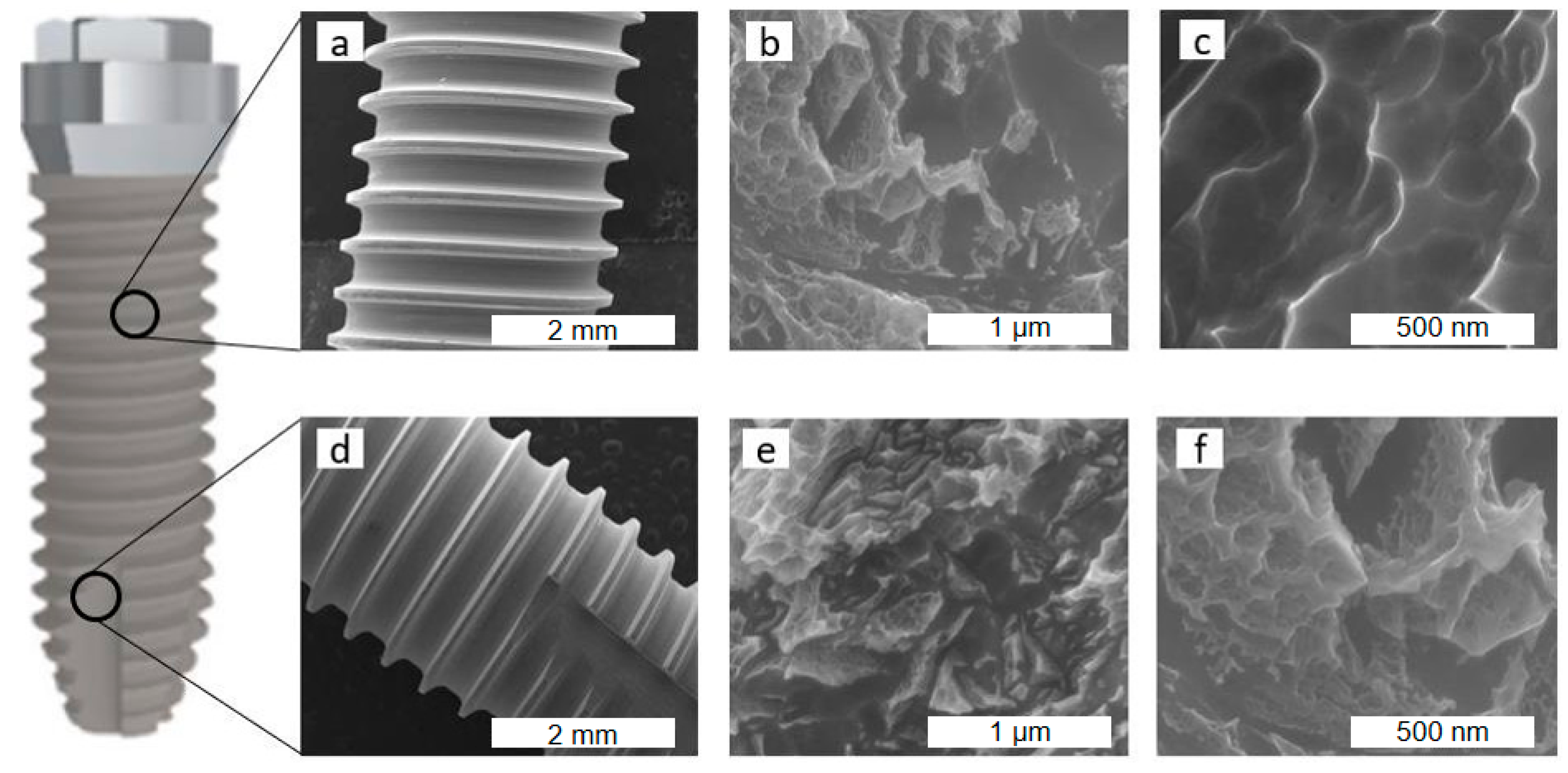 Materials 18 01632 g005