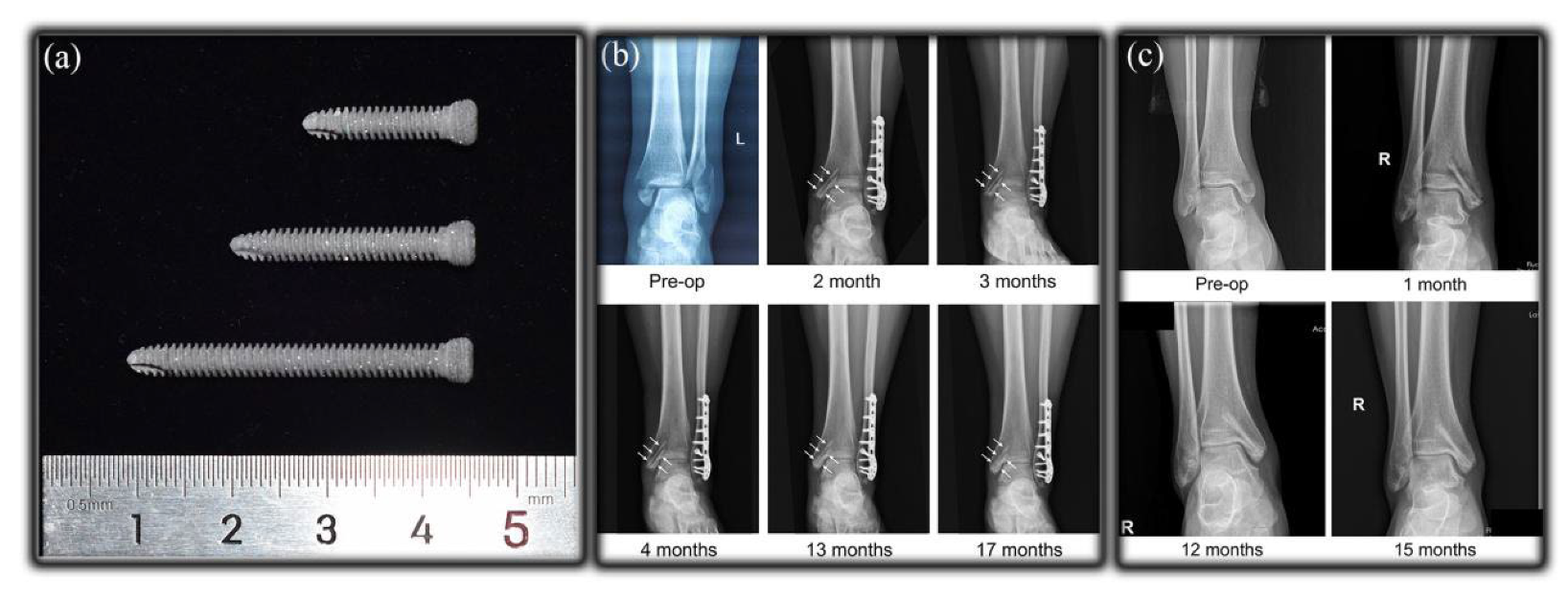 Materials 18 01718 g011