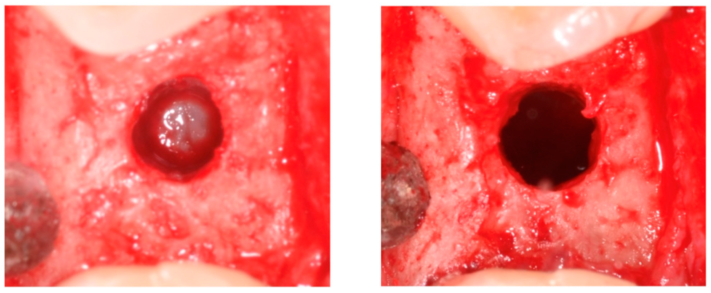 Materials 18 02230 g001