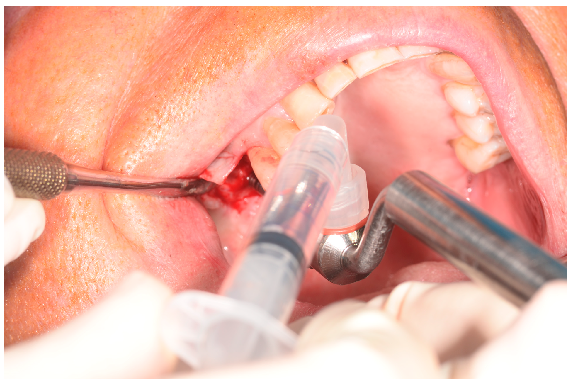 Materials 18 02230 g002