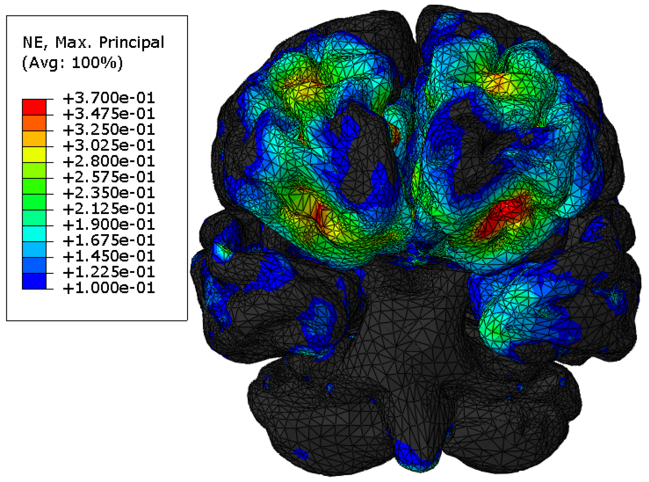 Mca 25 00012 g009 Mca 25 00012 g009