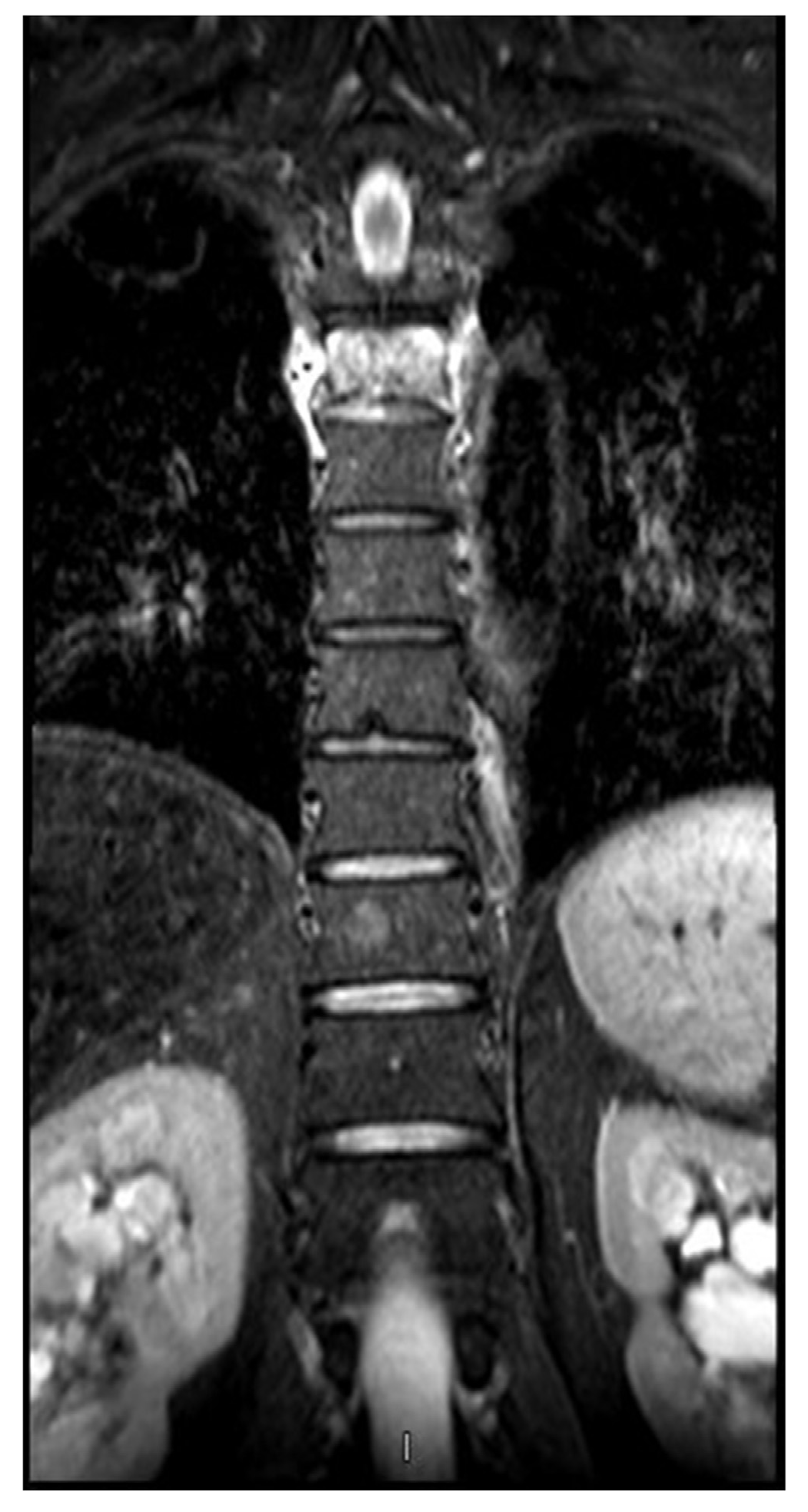 Medicina 53 00131 g002