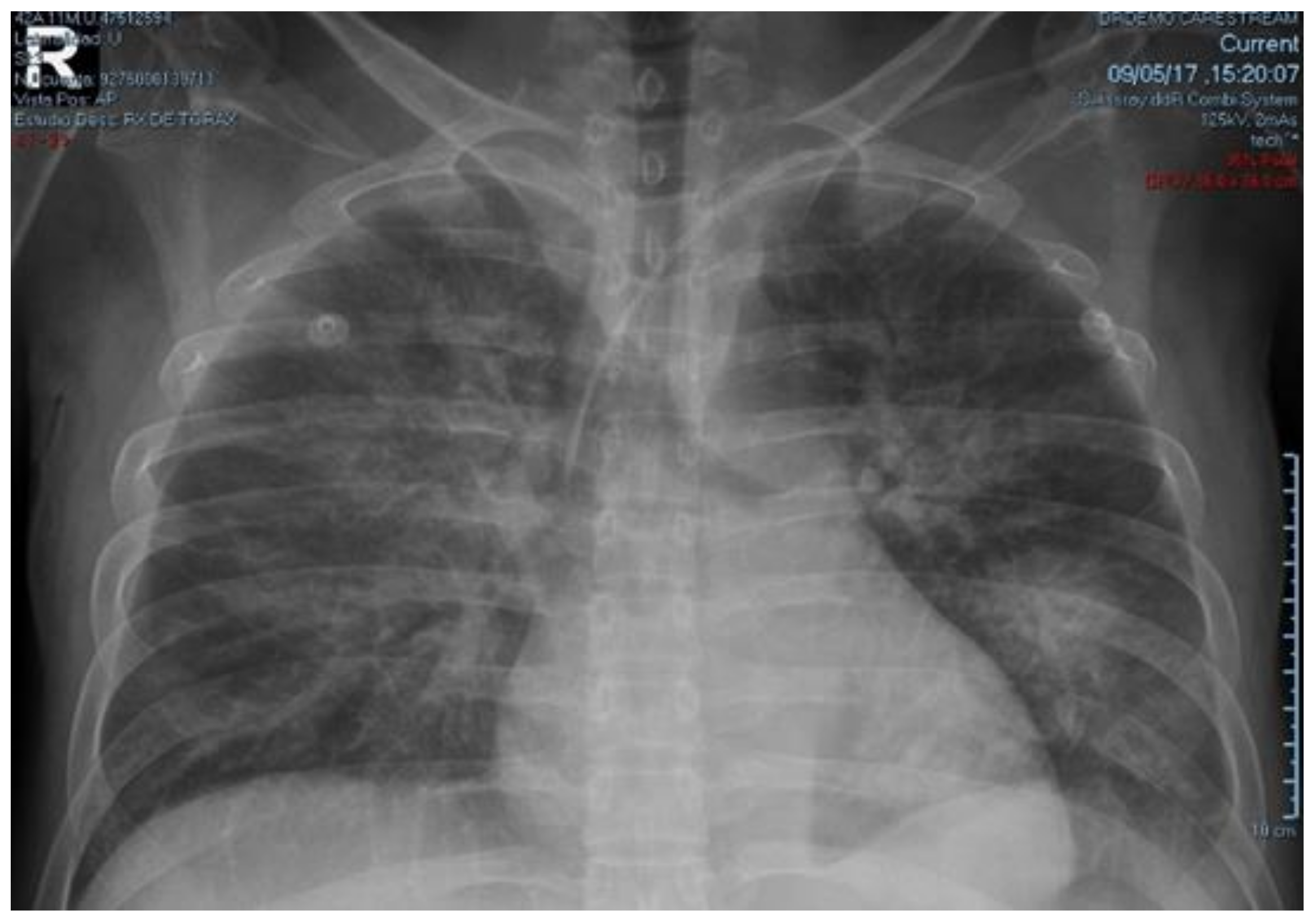 Medicina 54 00093 g002 Medicina 54 00093 g002