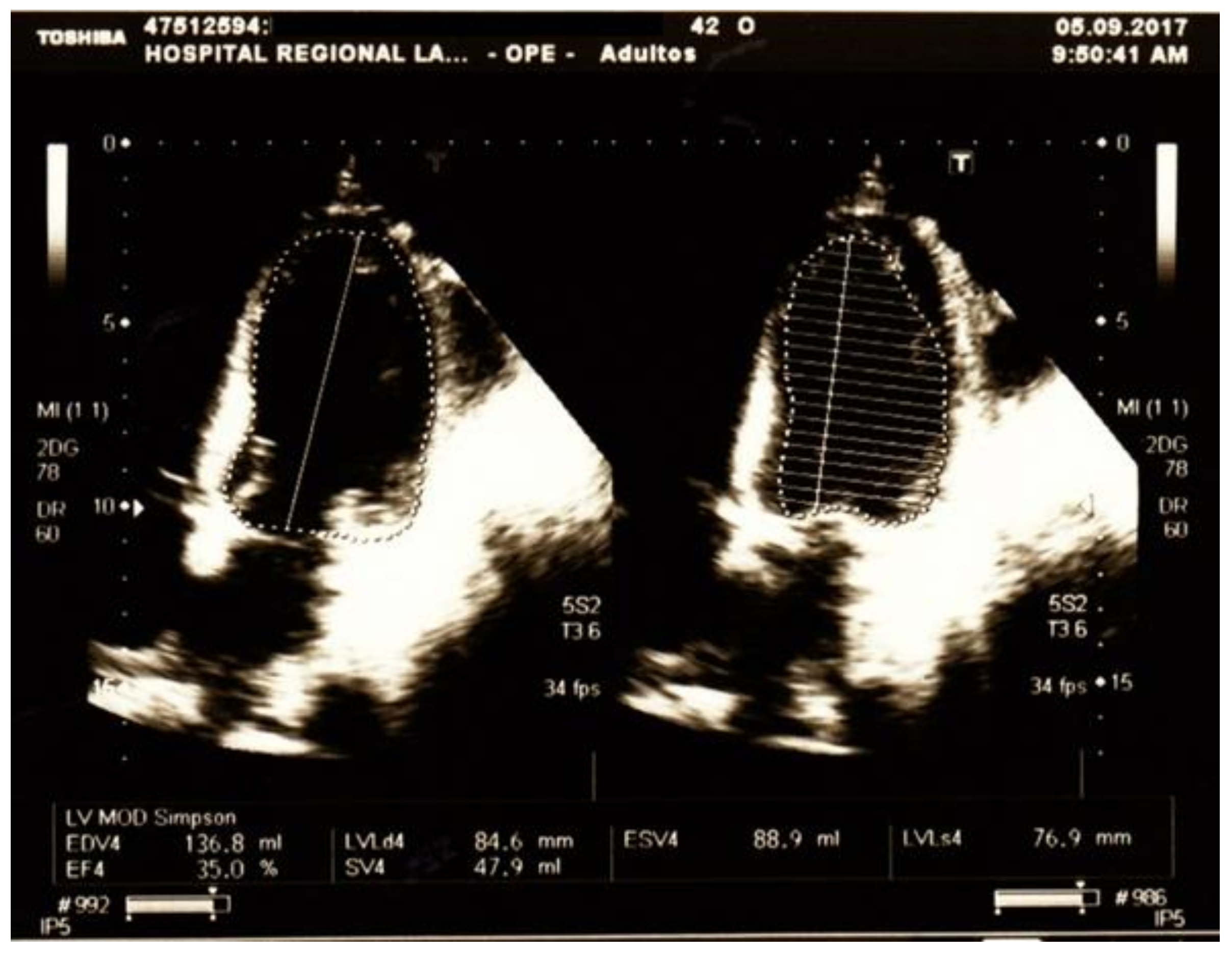 Medicina 54 00093 g003 Medicina 54 00093 g003