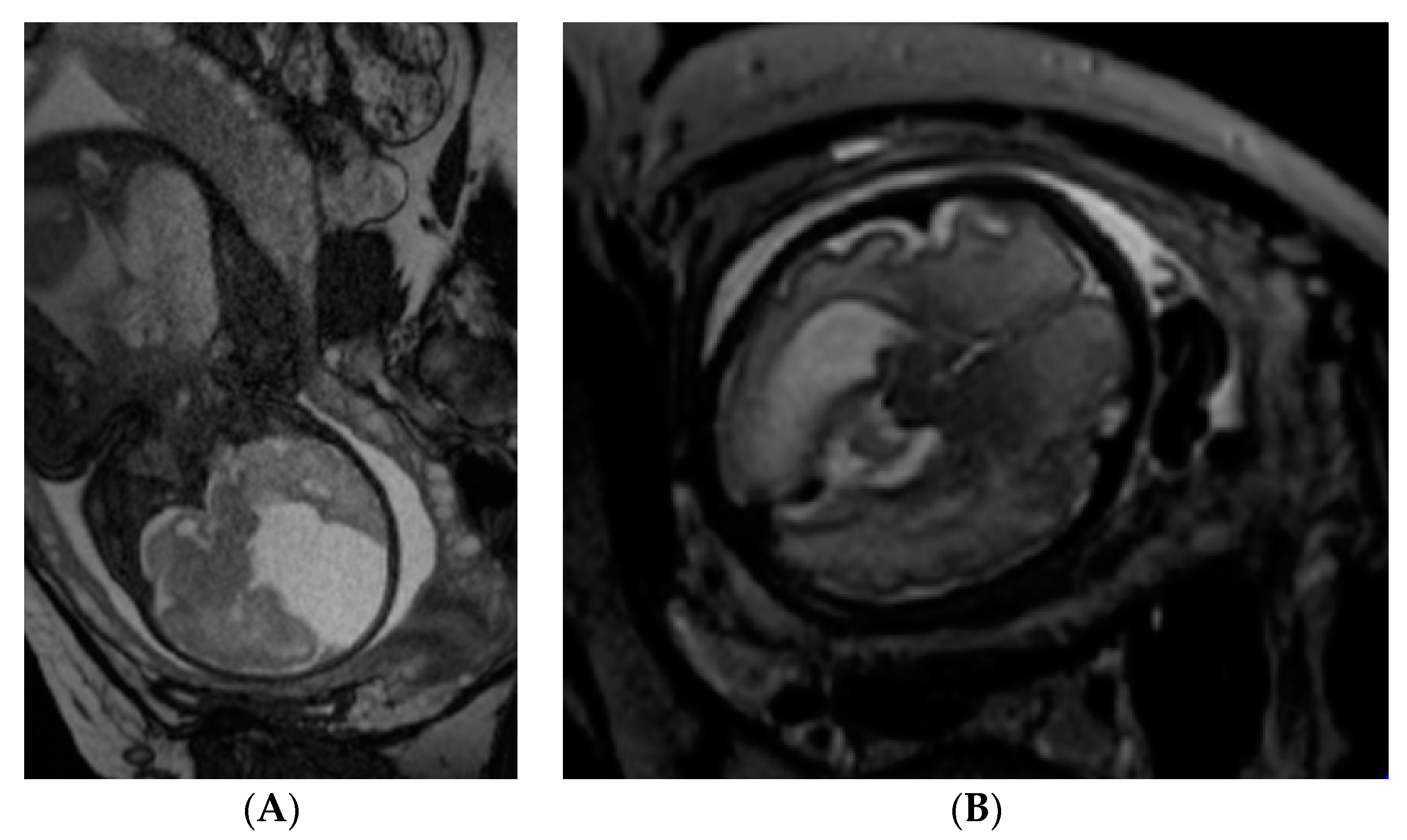 Journal of Magnetic Resonance Imaging: Vol 55, No 1