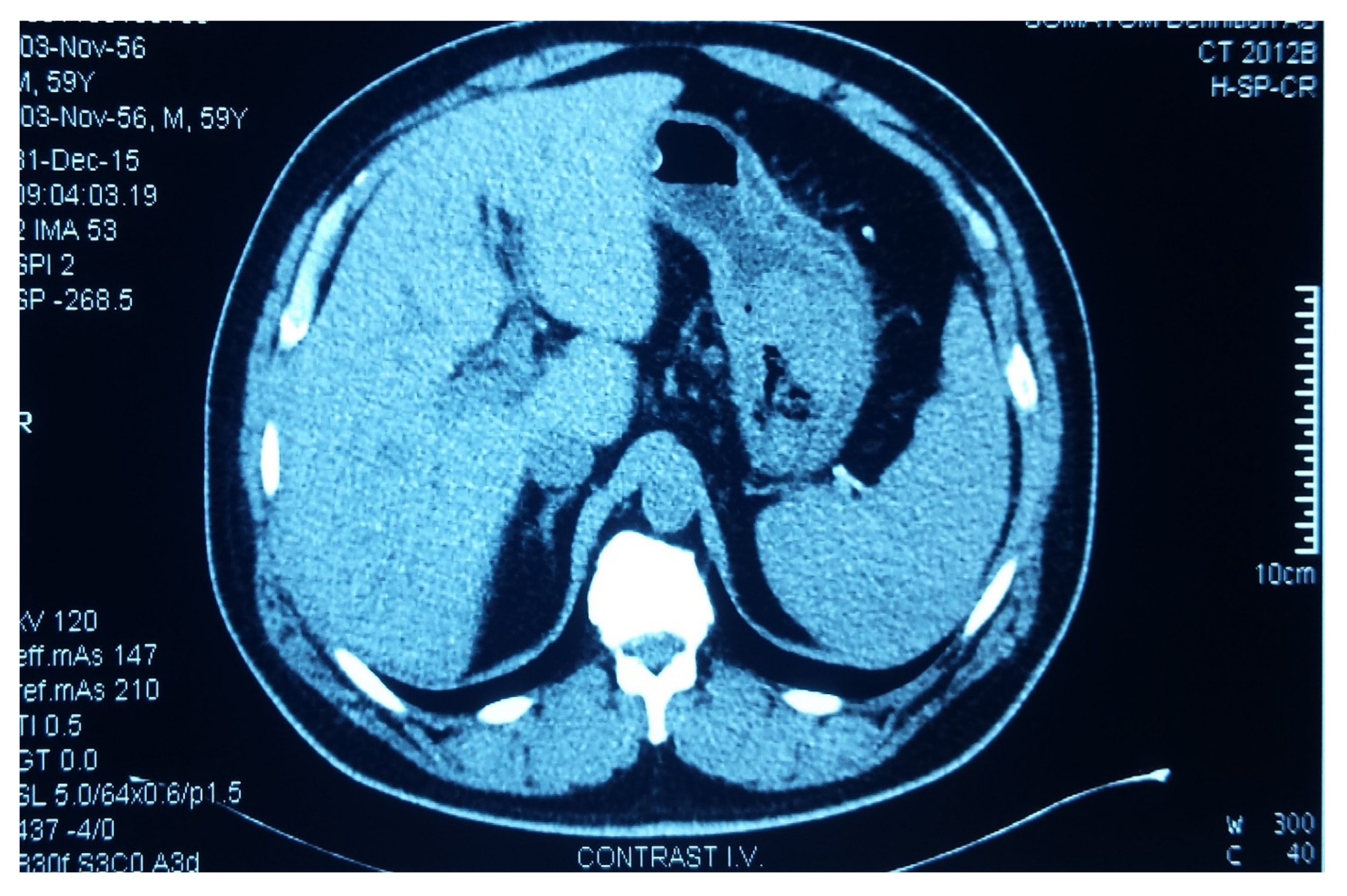 Medicina Free Full Text Gastric Adenocarcinoma - 