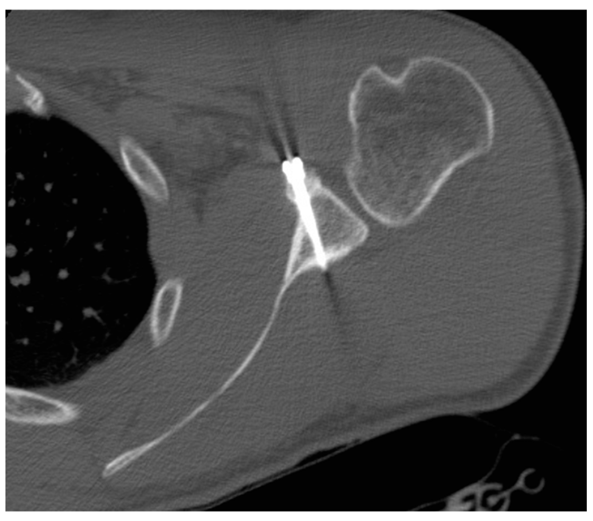 Medicina 55 00582 g005 Medicina 55 00582 g005