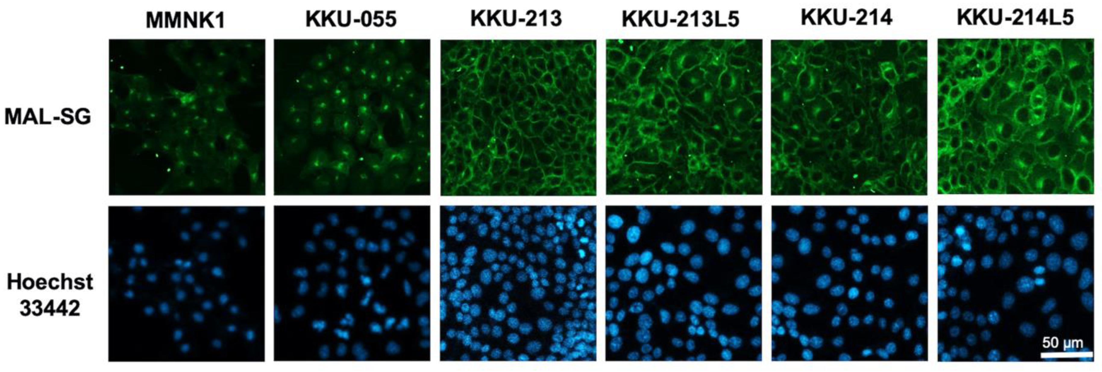 medicina free full text increase of mal ii binding alpha2 3 sialylated glycan is associated with 5 fu resistance and short survival of cholangiocarcinoma patients html