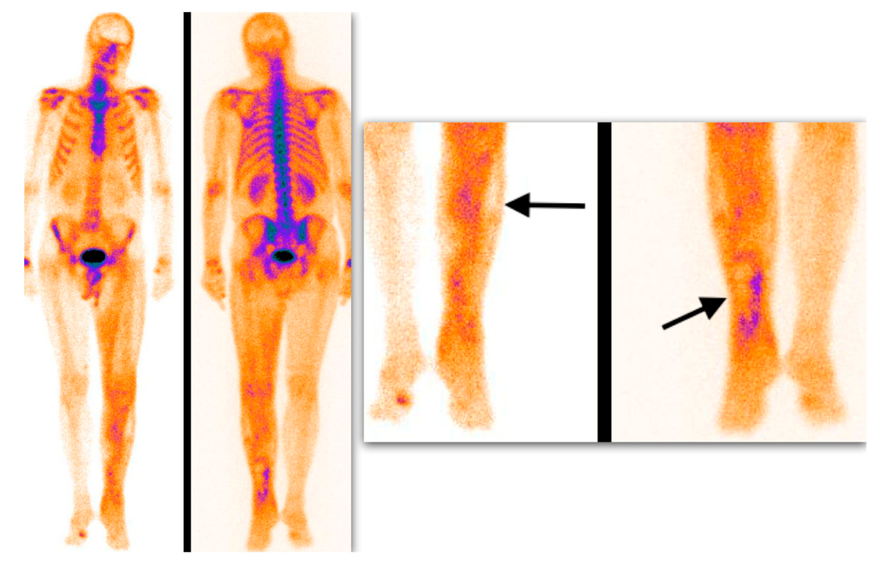 Medicina 55 00763 g004 Medicina 55 00763 g004