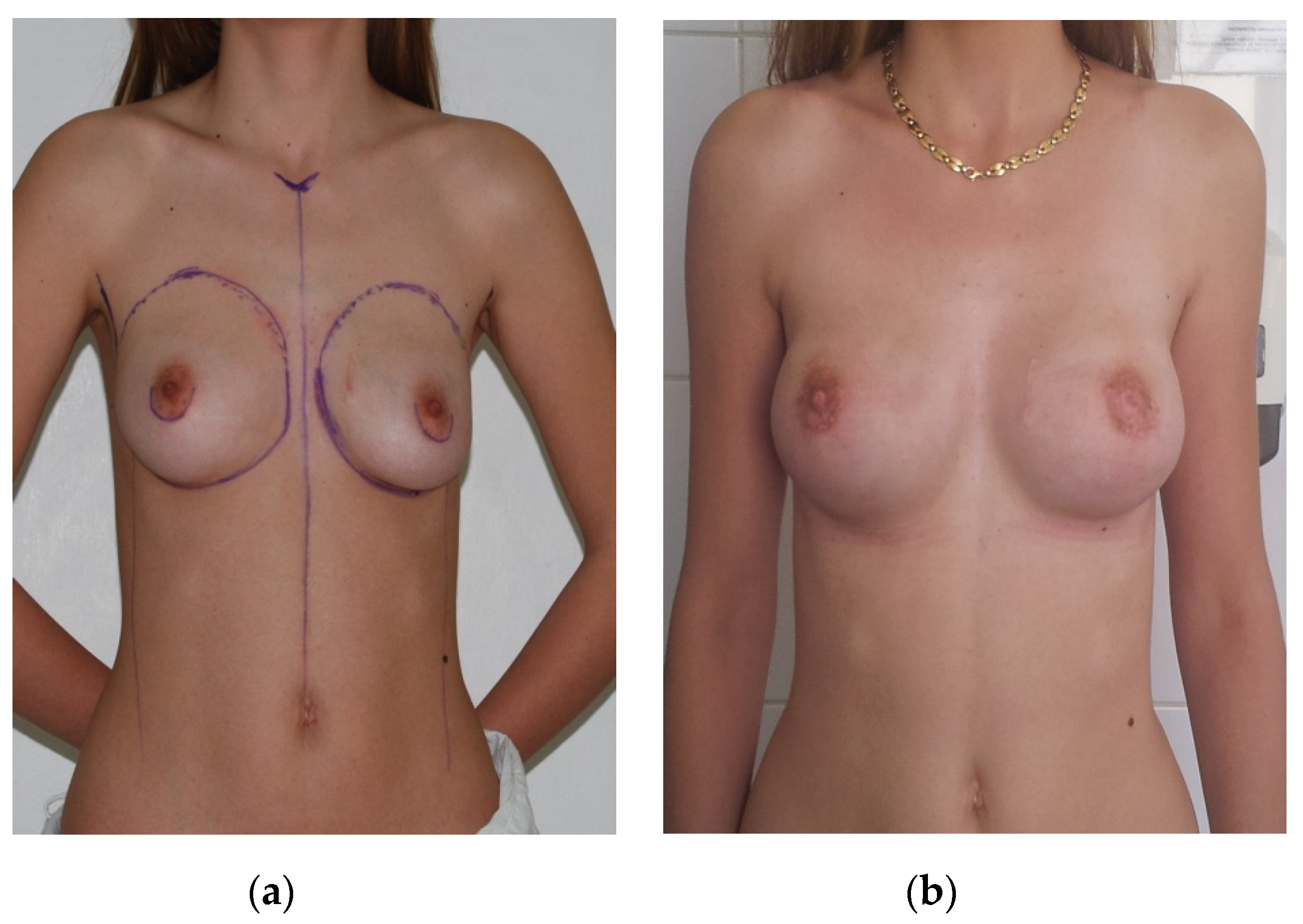 Medicina 56 00086 g001 Medicina 56 00086 g001