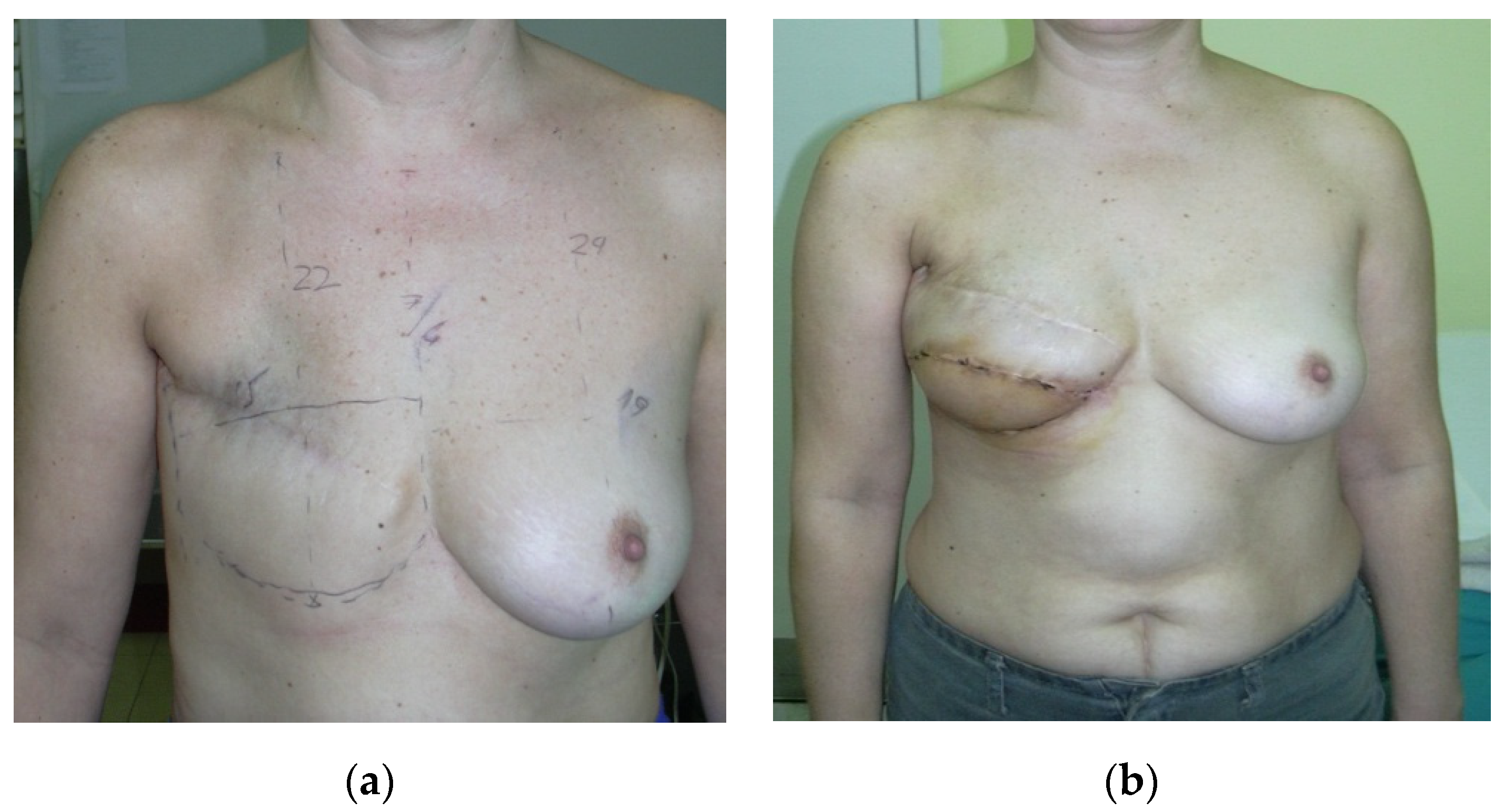 Medicina 56 00086 g002 Medicina 56 00086 g002