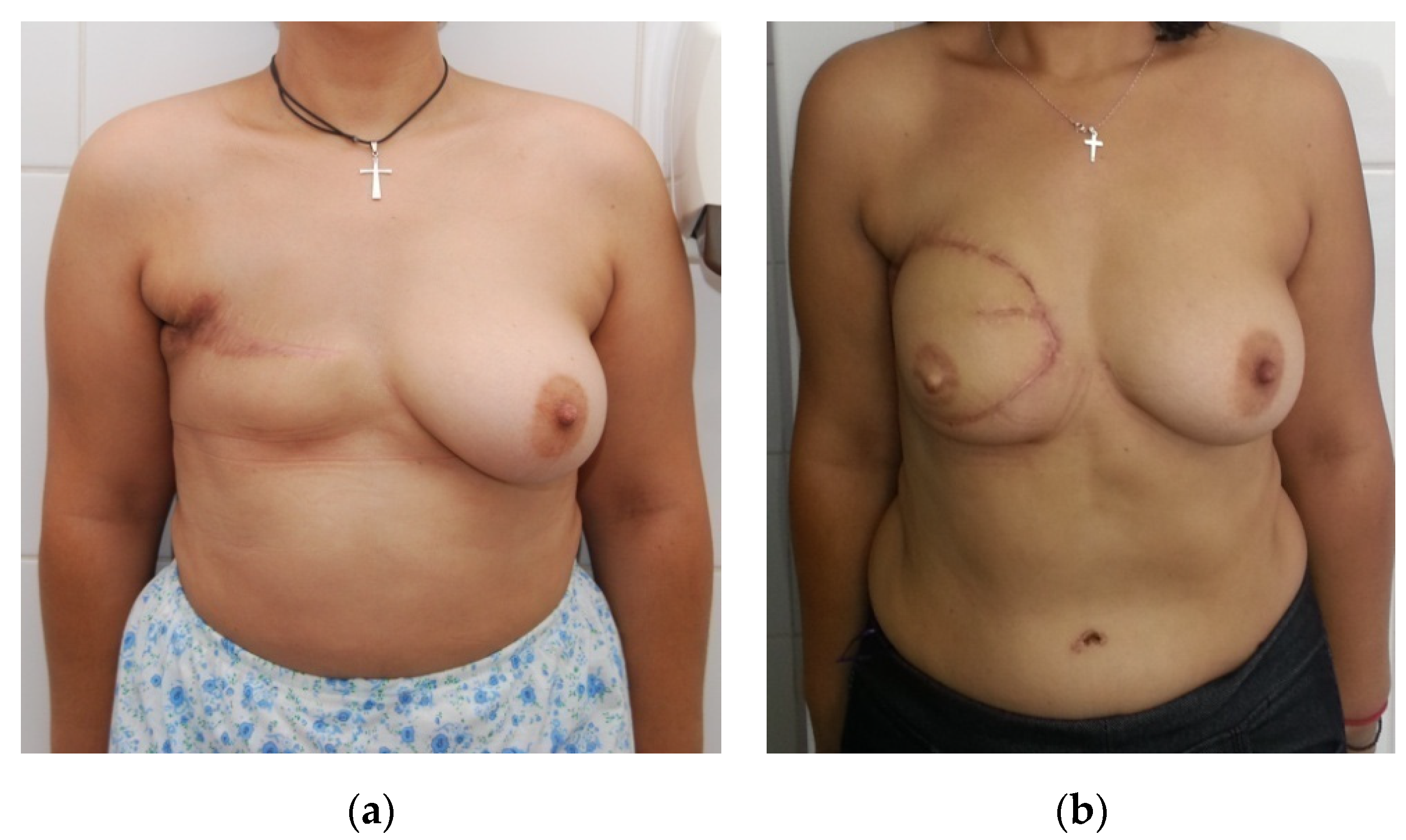 Medicina 56 00086 g003 Medicina 56 00086 g003