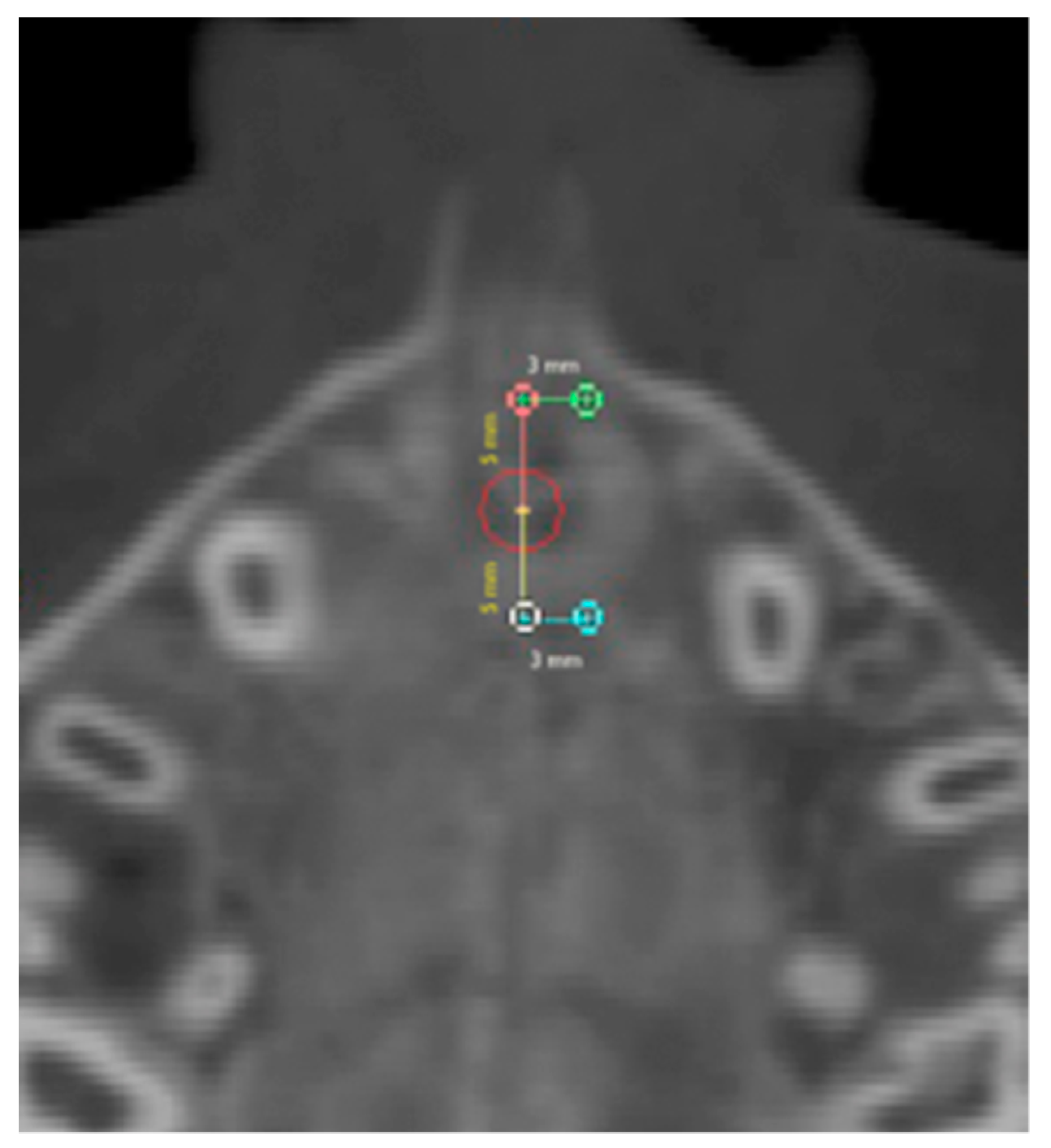 Medicina 56 00112 g003 Medicina 56 00112 g003