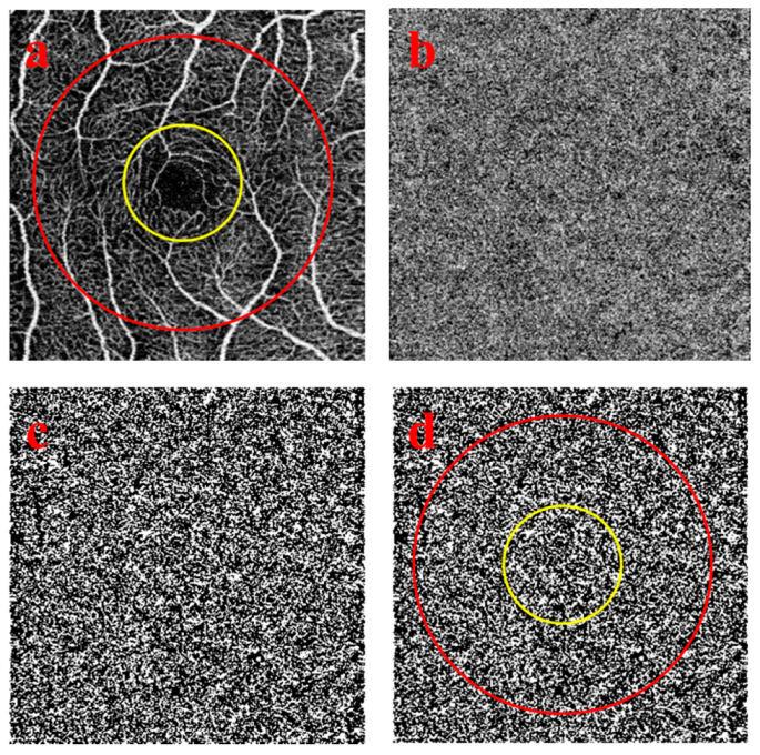 Medicina 56 00238 g001 Medicina 56 00238 g001