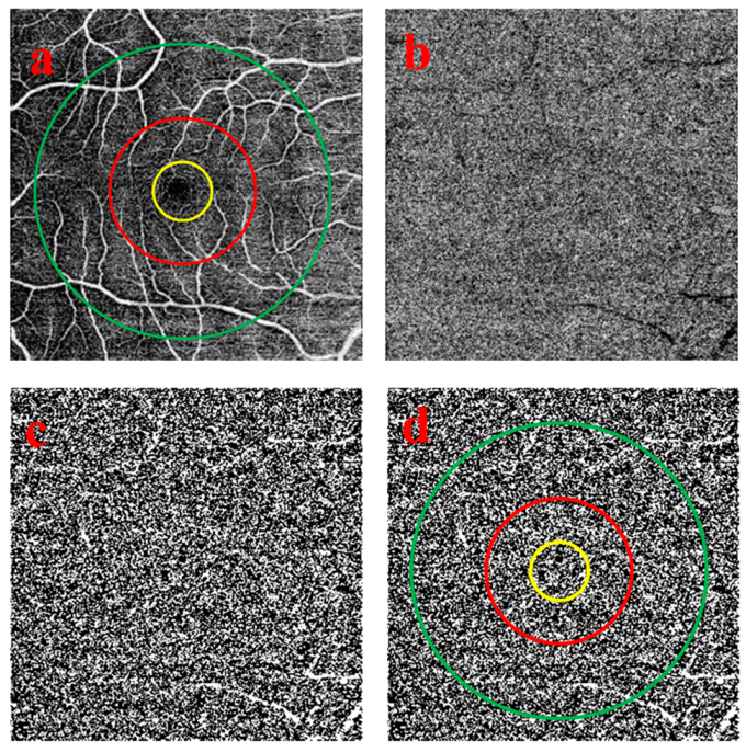 Medicina 56 00238 g002 Medicina 56 00238 g002