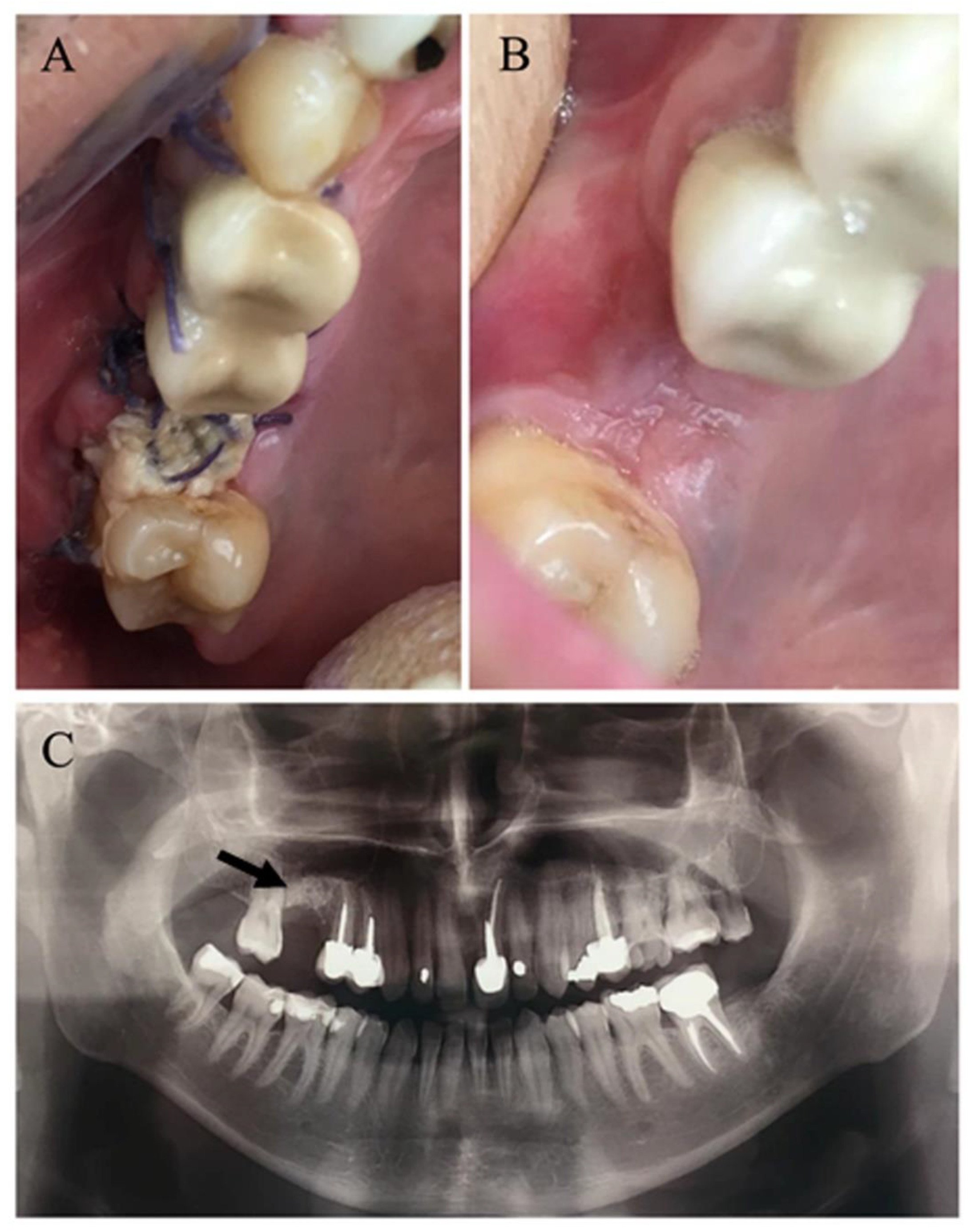 Medicina 56 00310 g003 Medicina 56 00310 g003