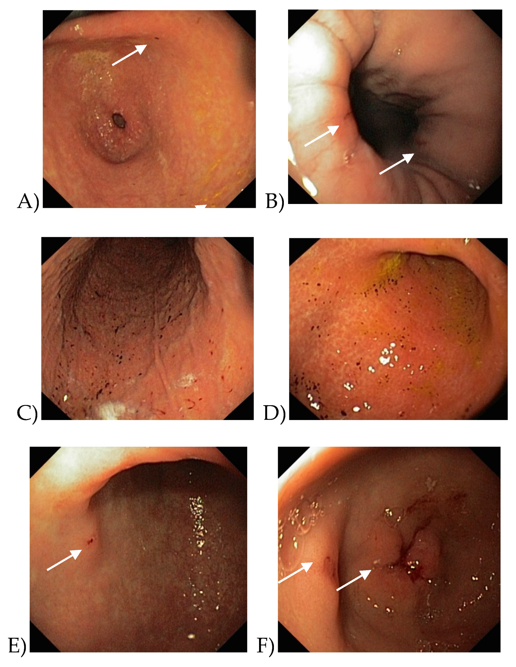 Medicina 56 00363 g004 Medicina 56 00363 g004