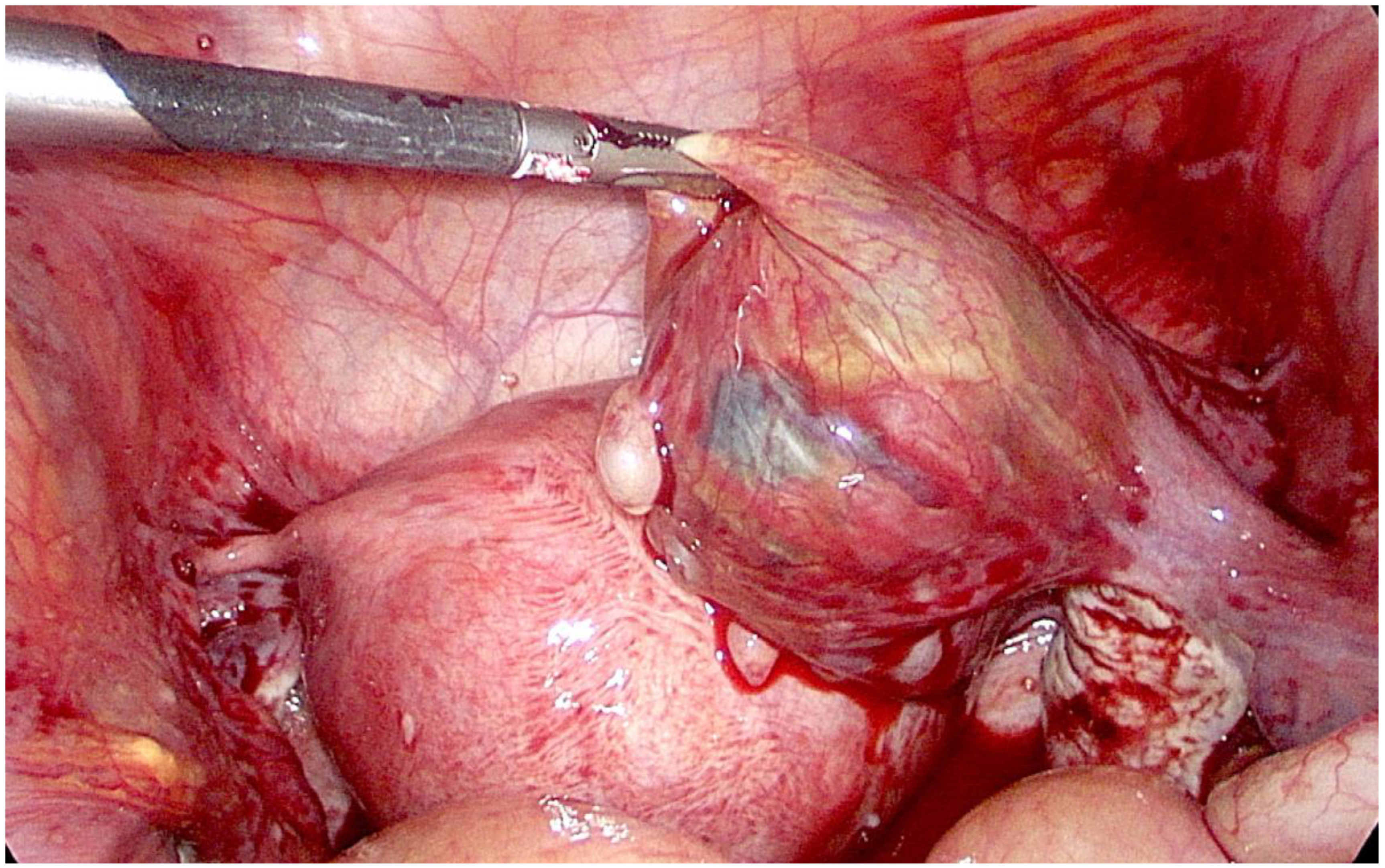 Medicina 56 00365 g003 Medicina 56 00365 g003