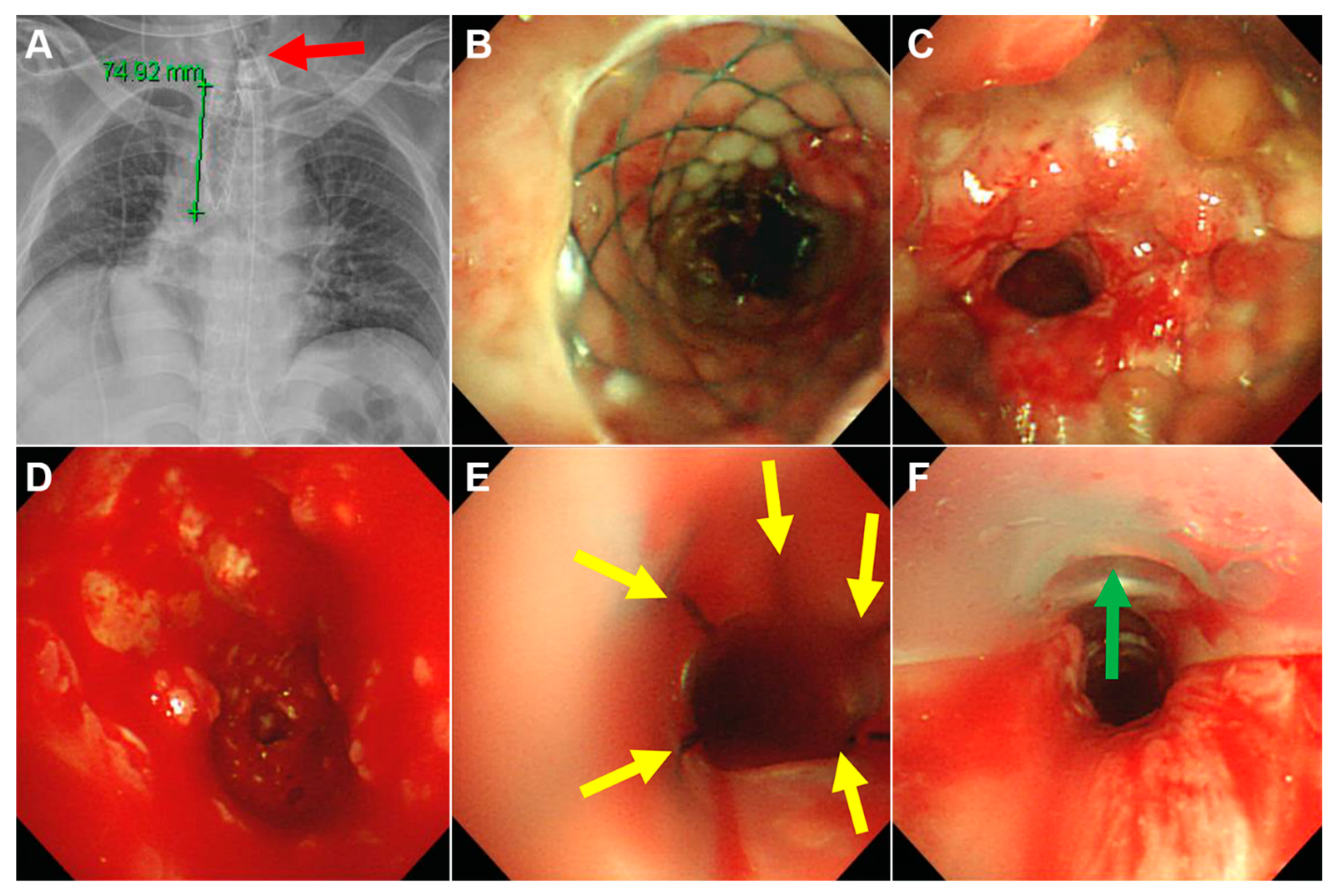 Medicina 56 00367 g003 Medicina 56 00367 g003