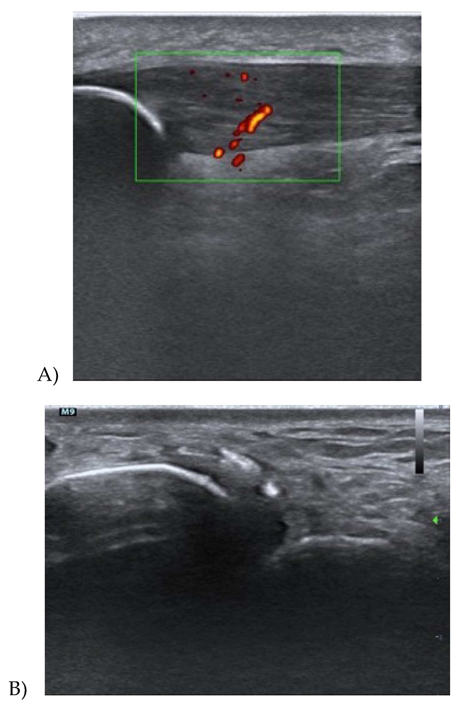 Medicina 56 00378 g002 Medicina 56 00378 g002