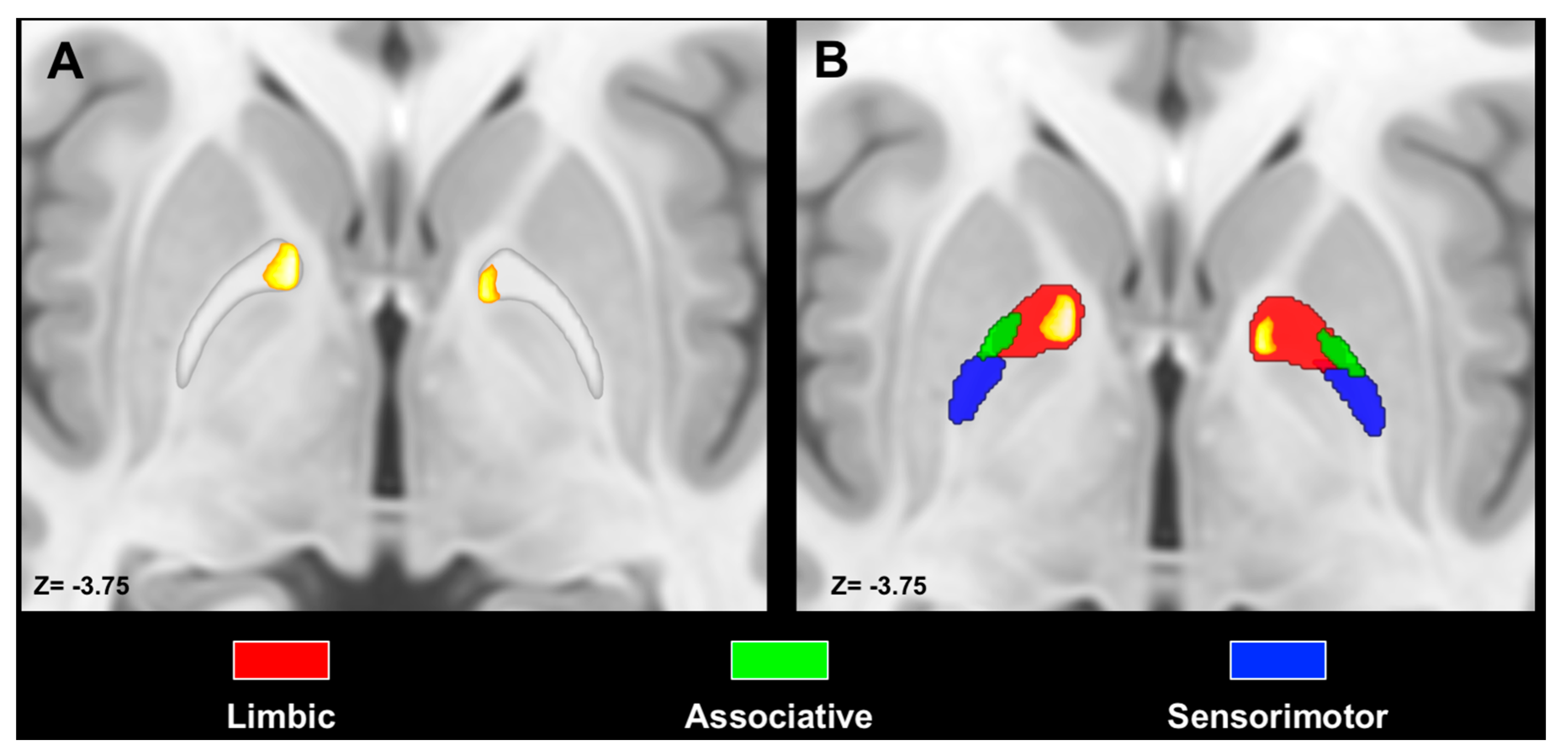 Download Medicina Free Full Text Anatomical Characterization Of The Human Structural Connectivity Between The Pedunculopontine Nucleus And Globus Pallidus Via Multi Shell Multi Tissue Tractography Html PSD Mockup Templates