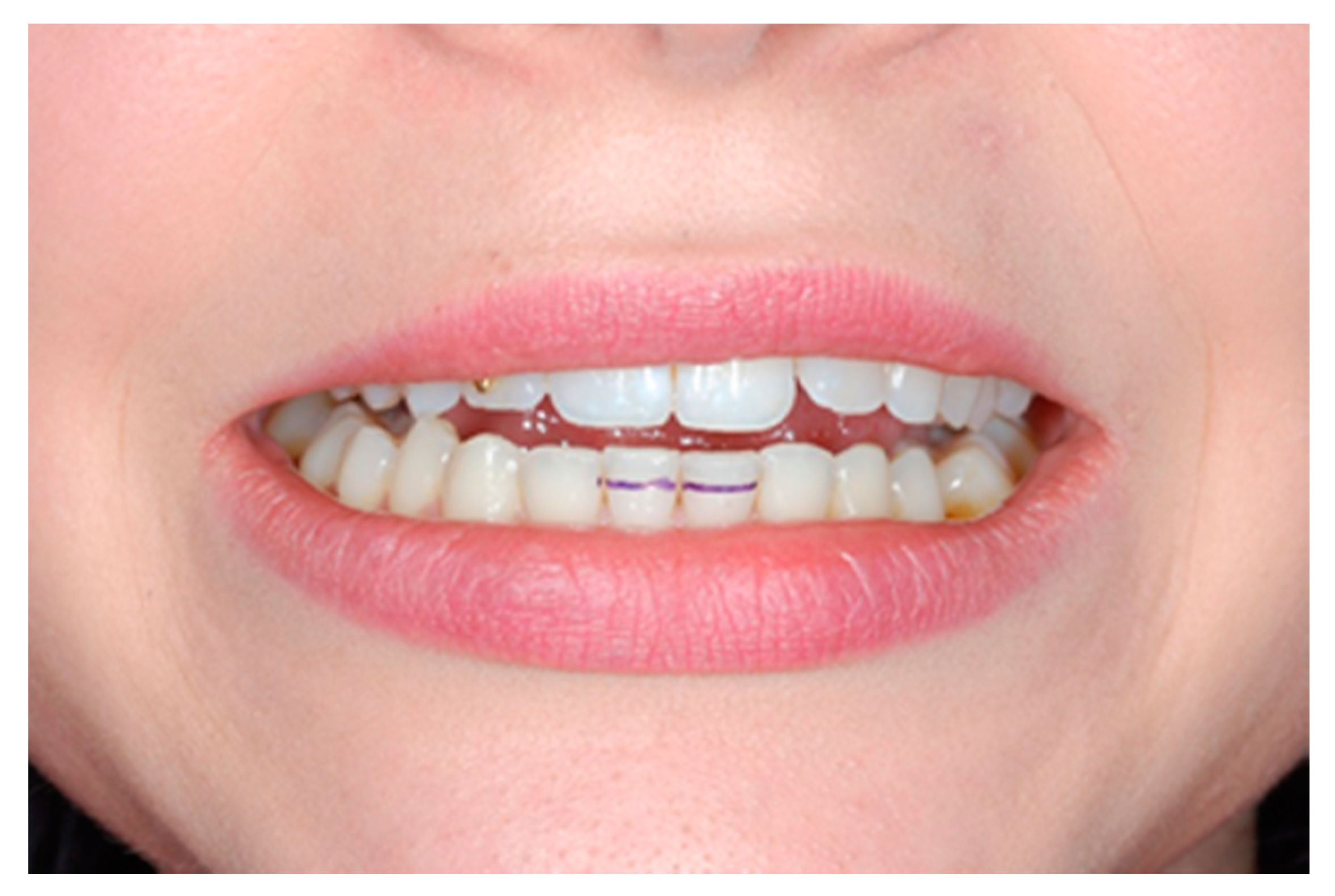 Medicina 56 00472 g002 Medicina 56 00472 g002