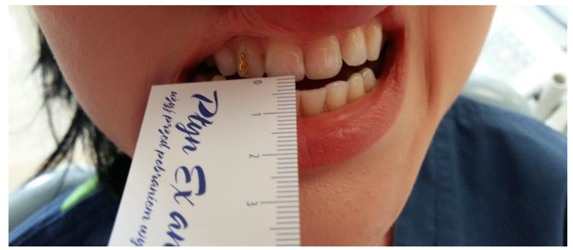 Medicina 56 00472 g005 Medicina 56 00472 g005