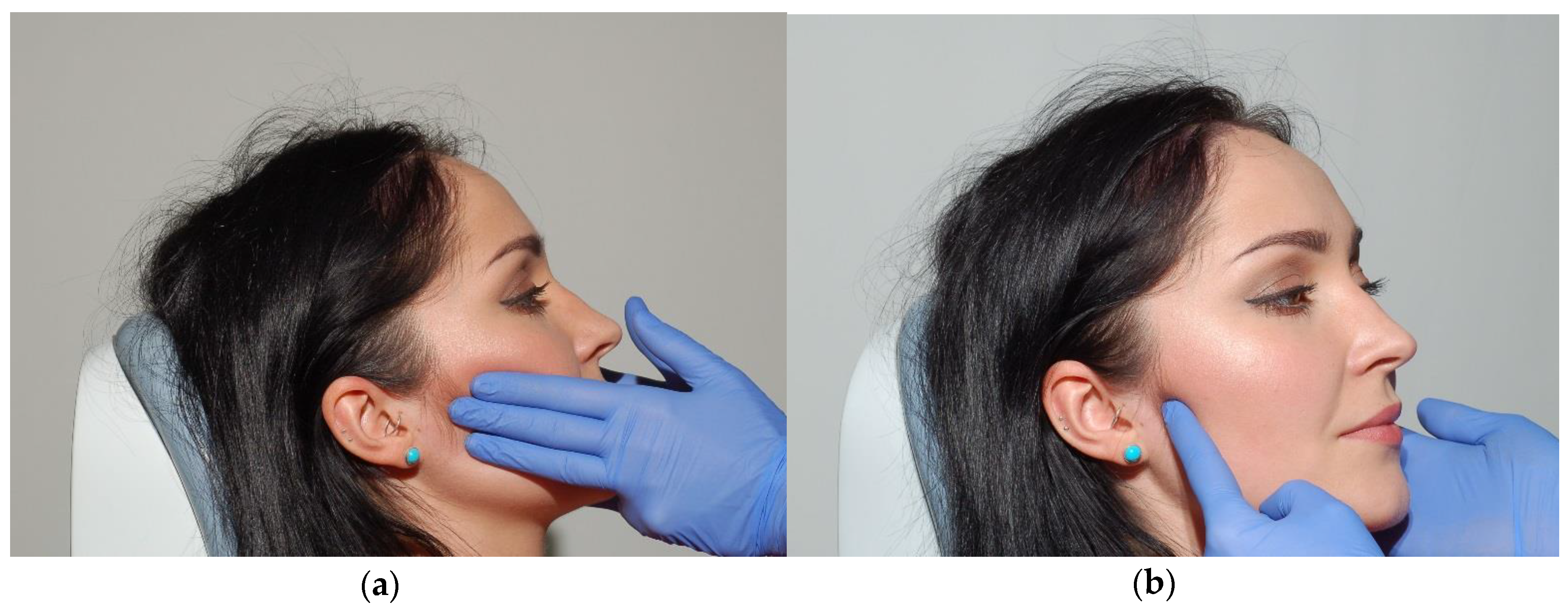 Medicina 56 00472 g009 Medicina 56 00472 g009