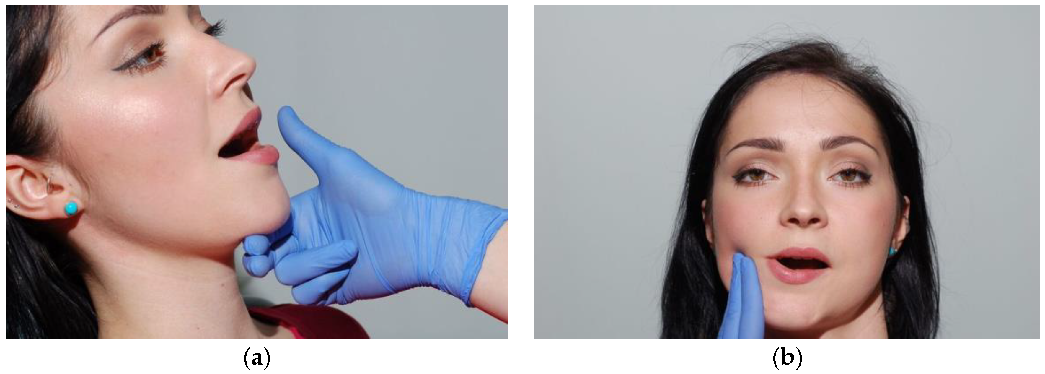 Medicina 56 00472 g014 Medicina 56 00472 g014