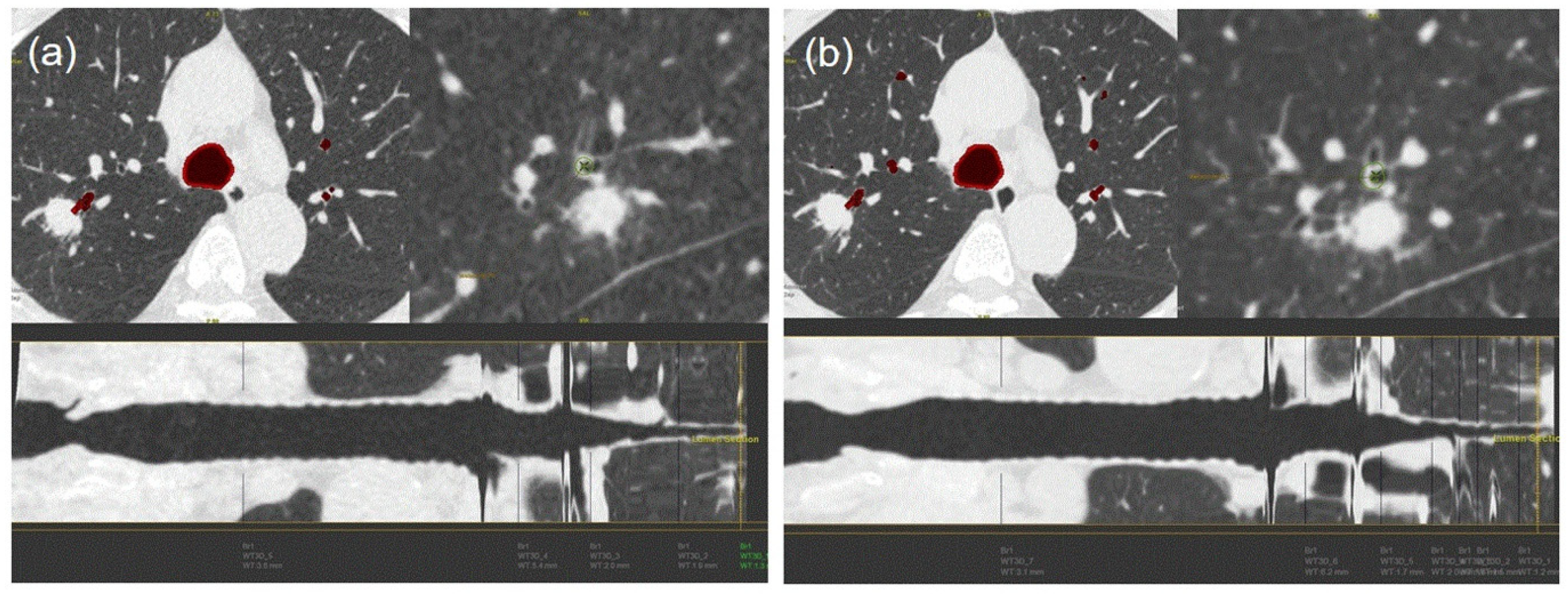 Medicina 56 00479 g003 Medicina 56 00479 g003