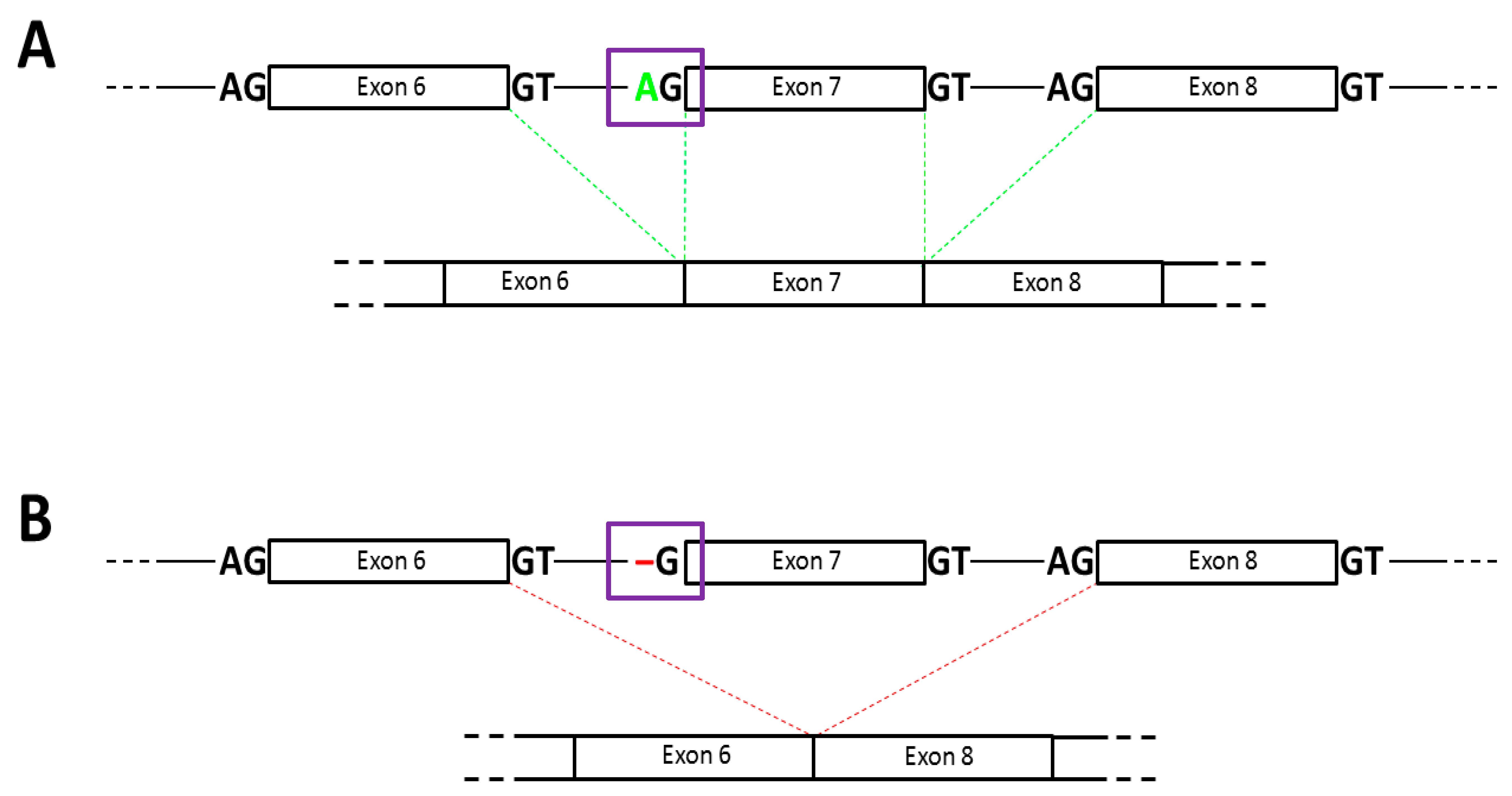 Medicina Free Full Text Novel Splice Site Mutation in the