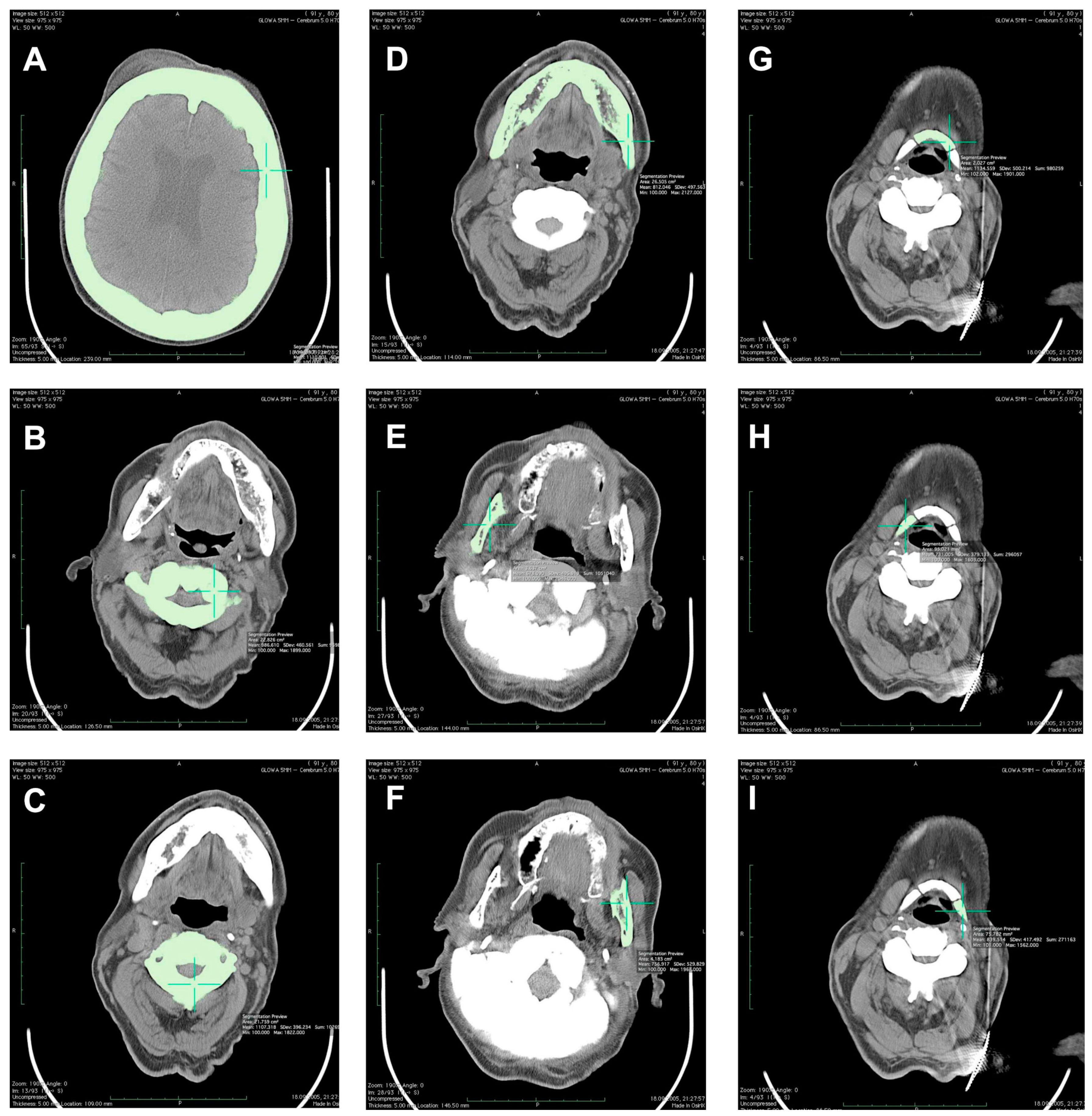 Medicina 56 00518 g002 Medicina 56 00518 g002