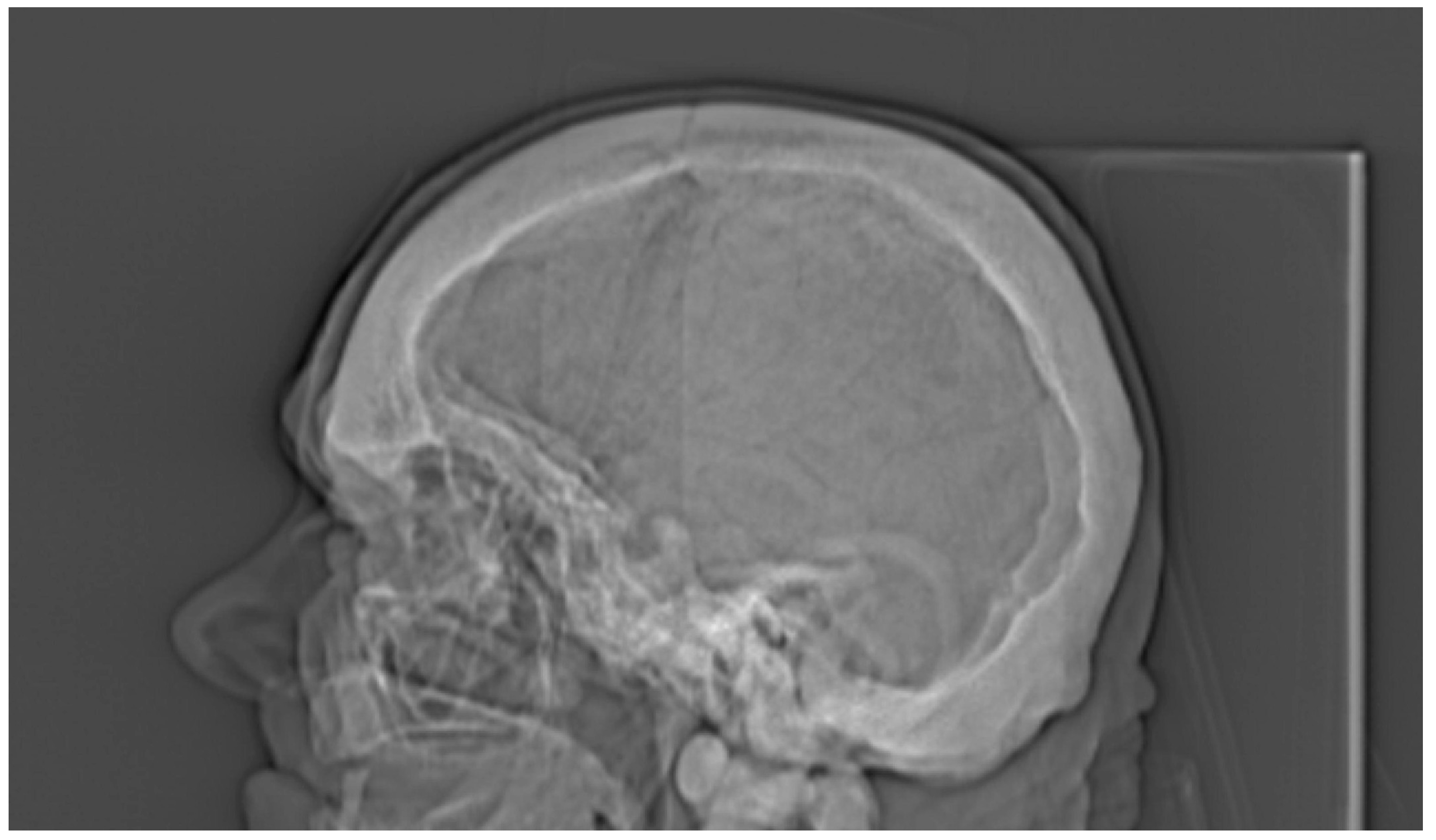 Medicina 56 00518 g004 Medicina 56 00518 g004