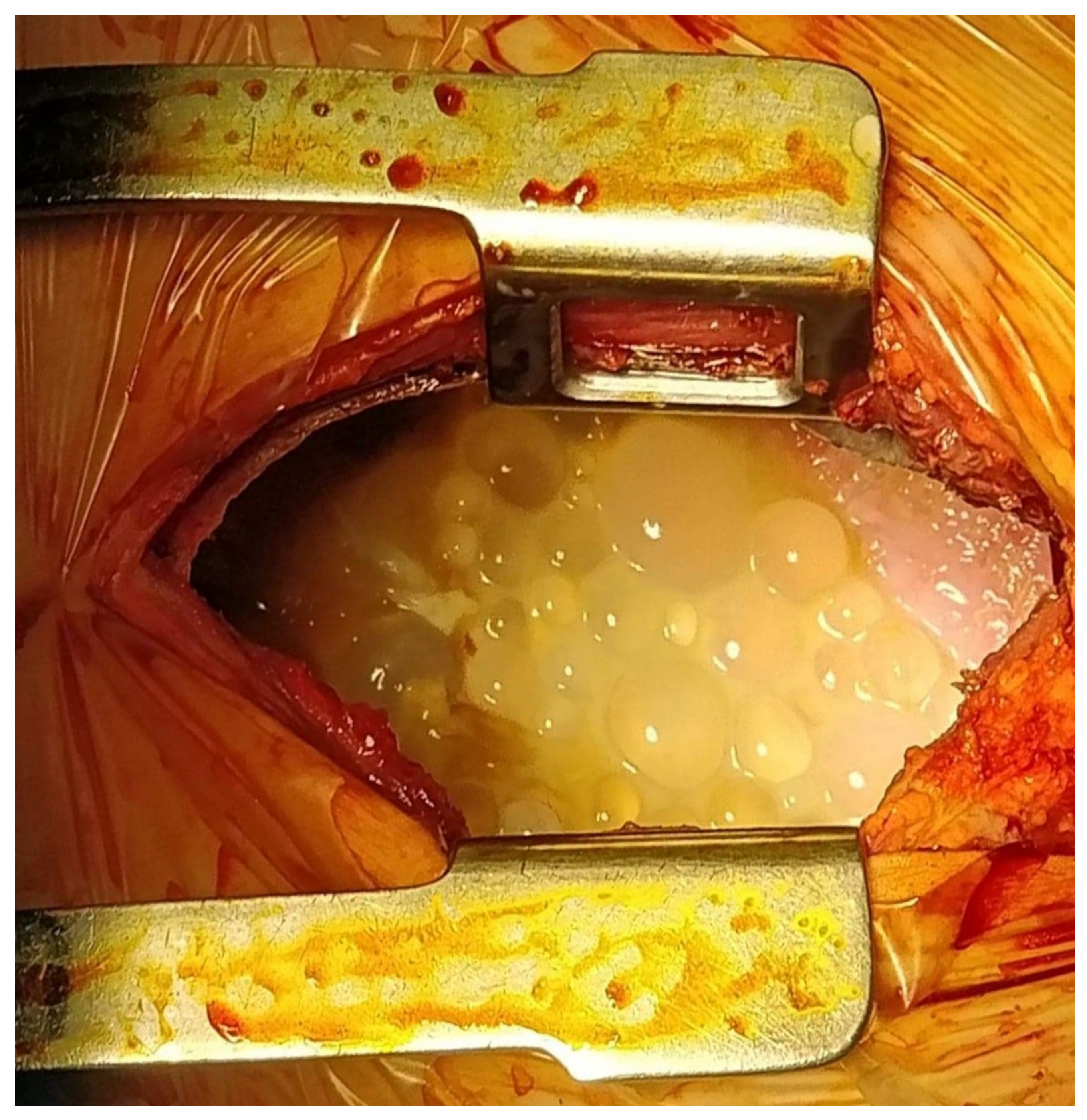 Medicina 56 00567 g002 Medicina 56 00567 g002