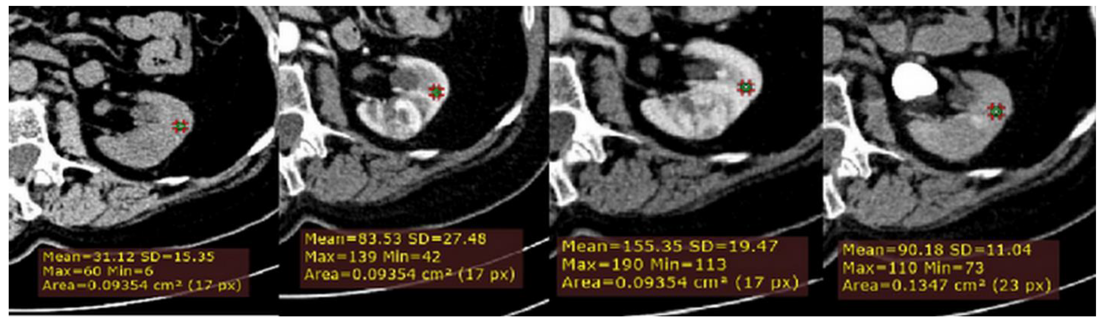 Medicina 56 00569 g002 Medicina 56 00569 g002