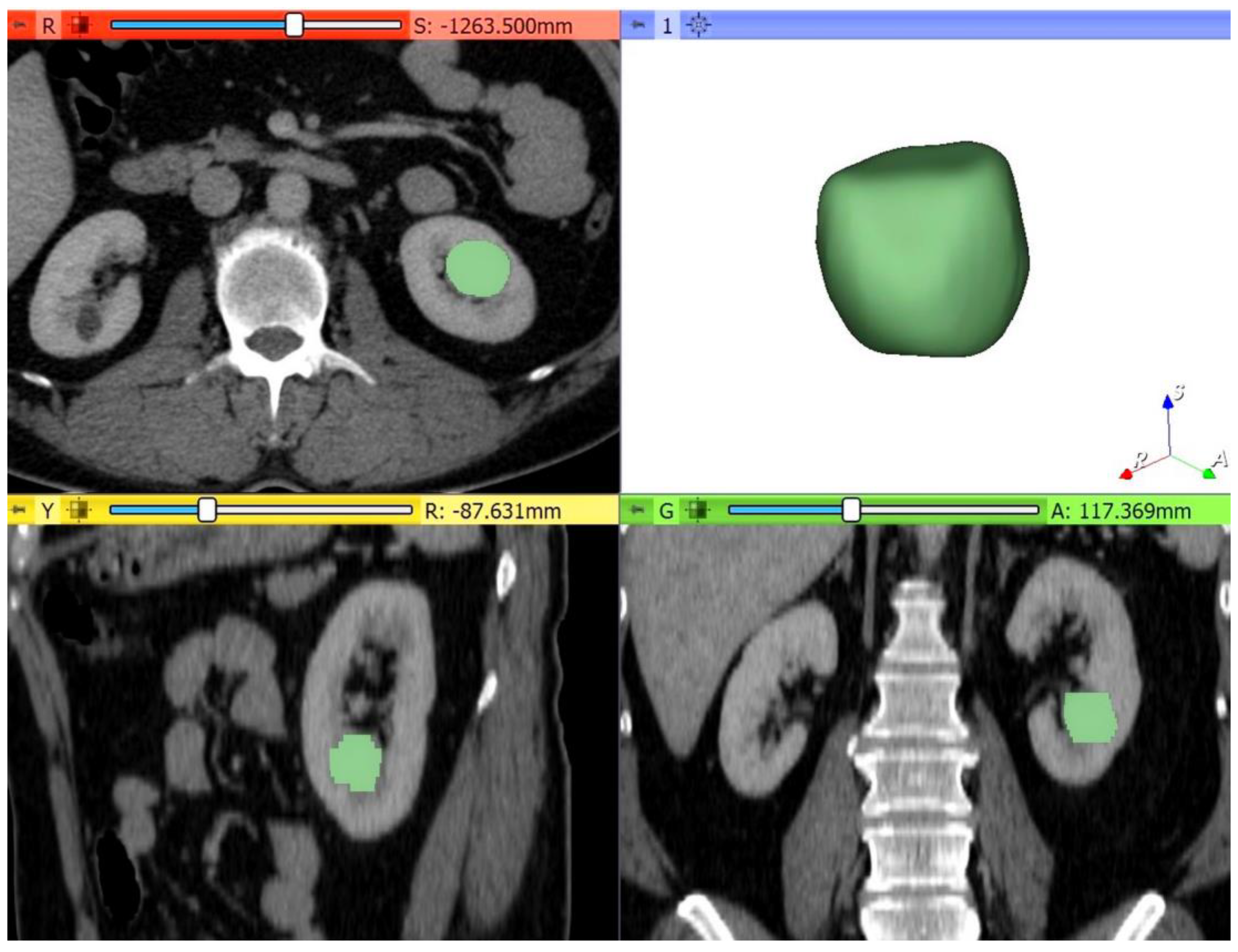 Medicina 56 00569 g003 Medicina 56 00569 g003