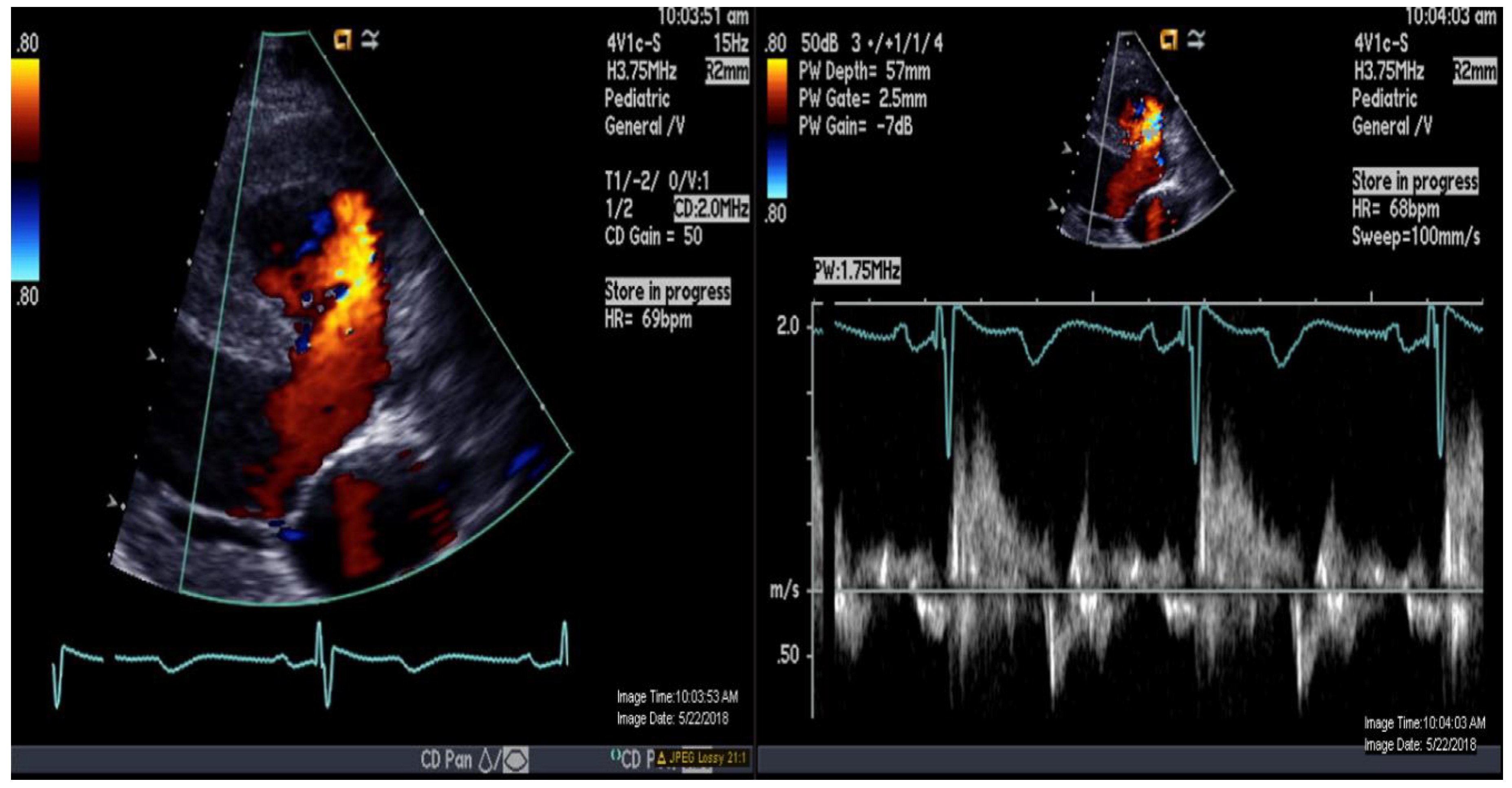 Medicina 56 00636 g002