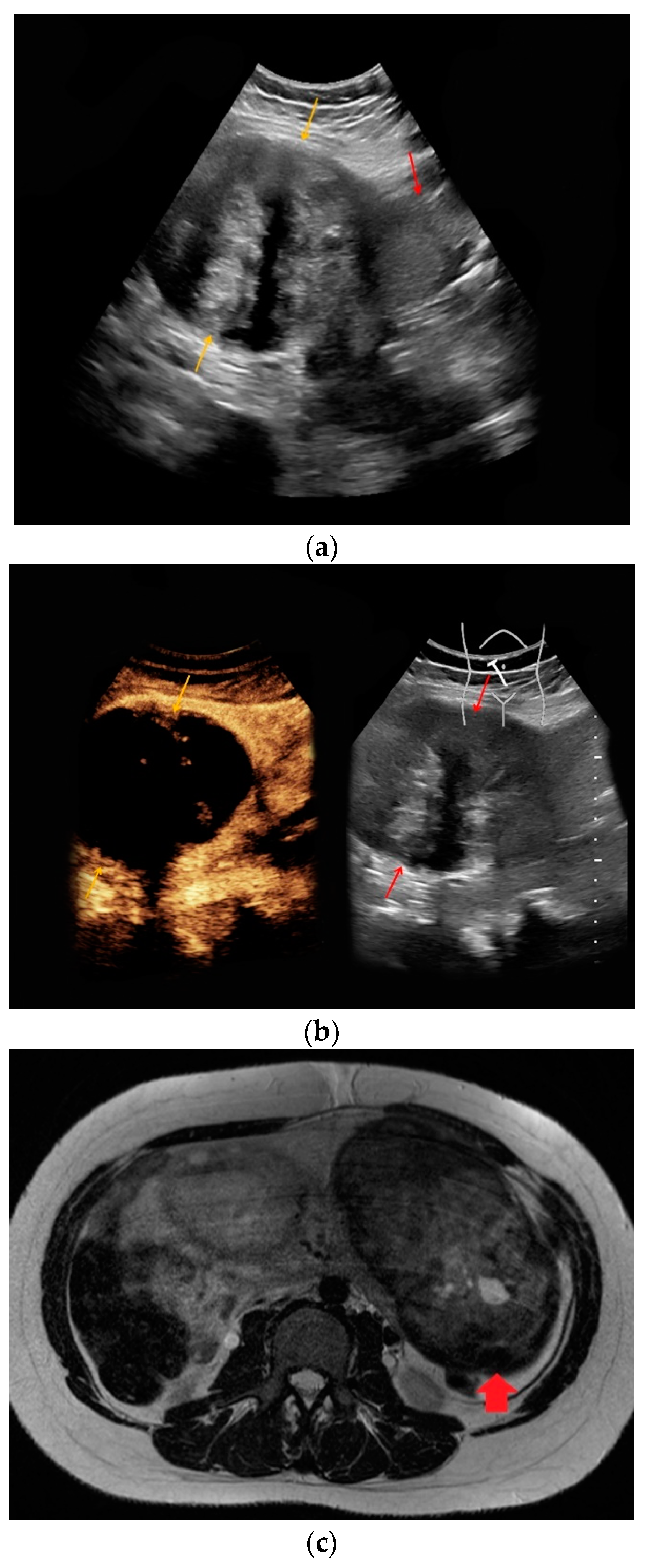 Medicina 56 00675 g002 Medicina 56 00675 g002